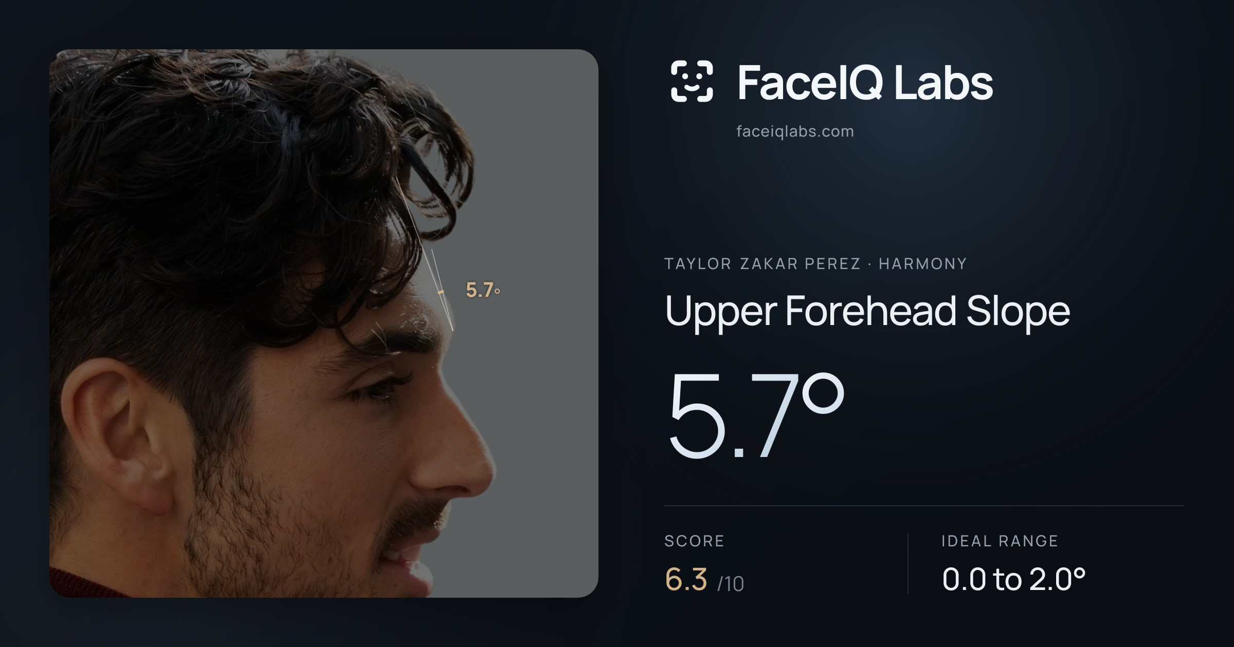 Taylor Zakar Perez Upper Forehead Slope: 5.7°, drawn on the photo
