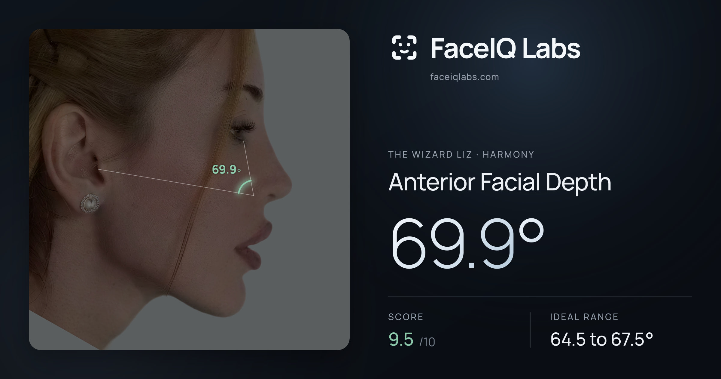 The Wizard Liz Anterior Facial Depth: 69.9°, drawn on the photo