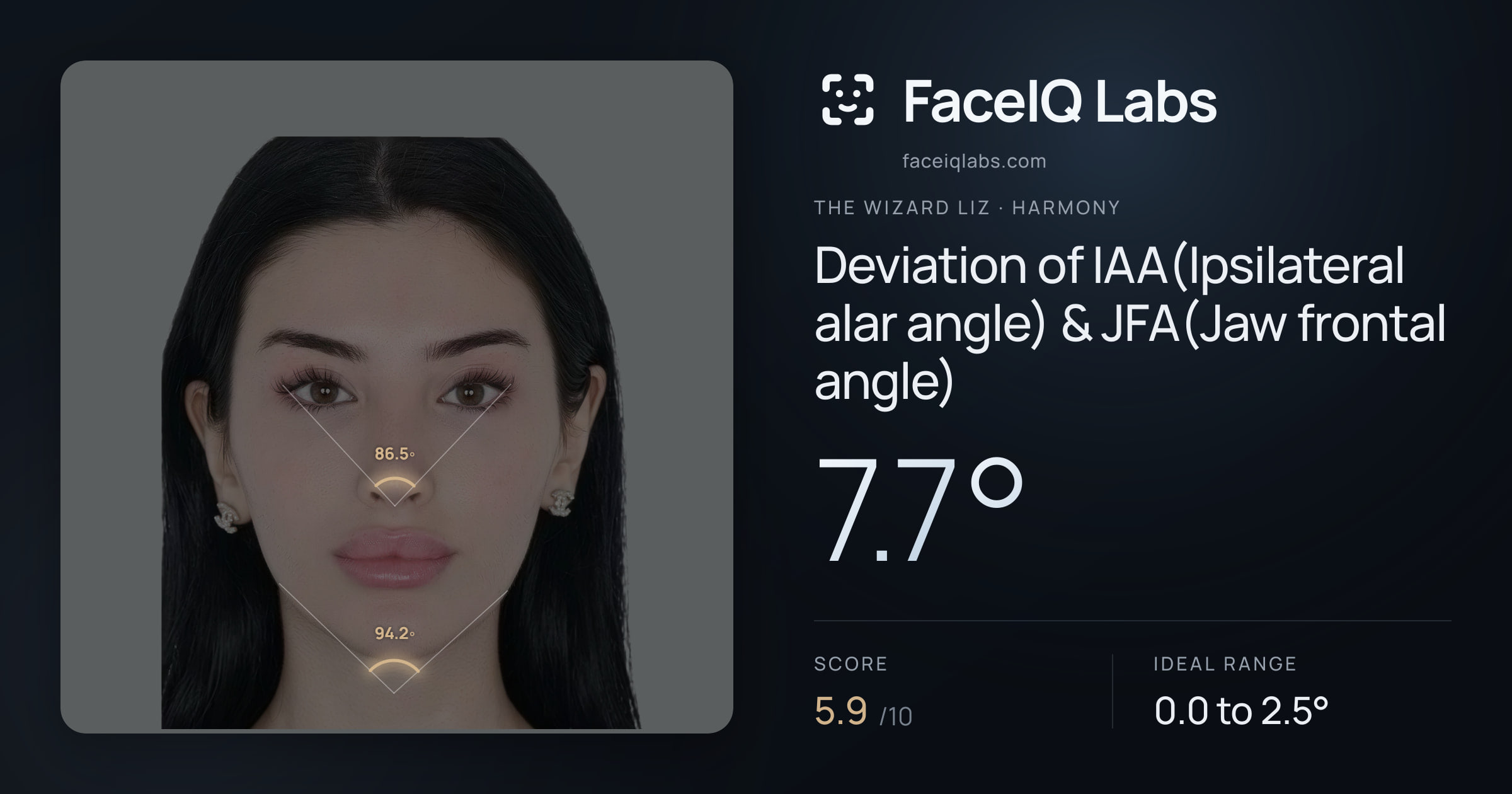 The Wizard Liz Deviation of IAA(Ipsilateral alar angle) & JFA(Jaw frontal angle): 7.7°, drawn on the photo