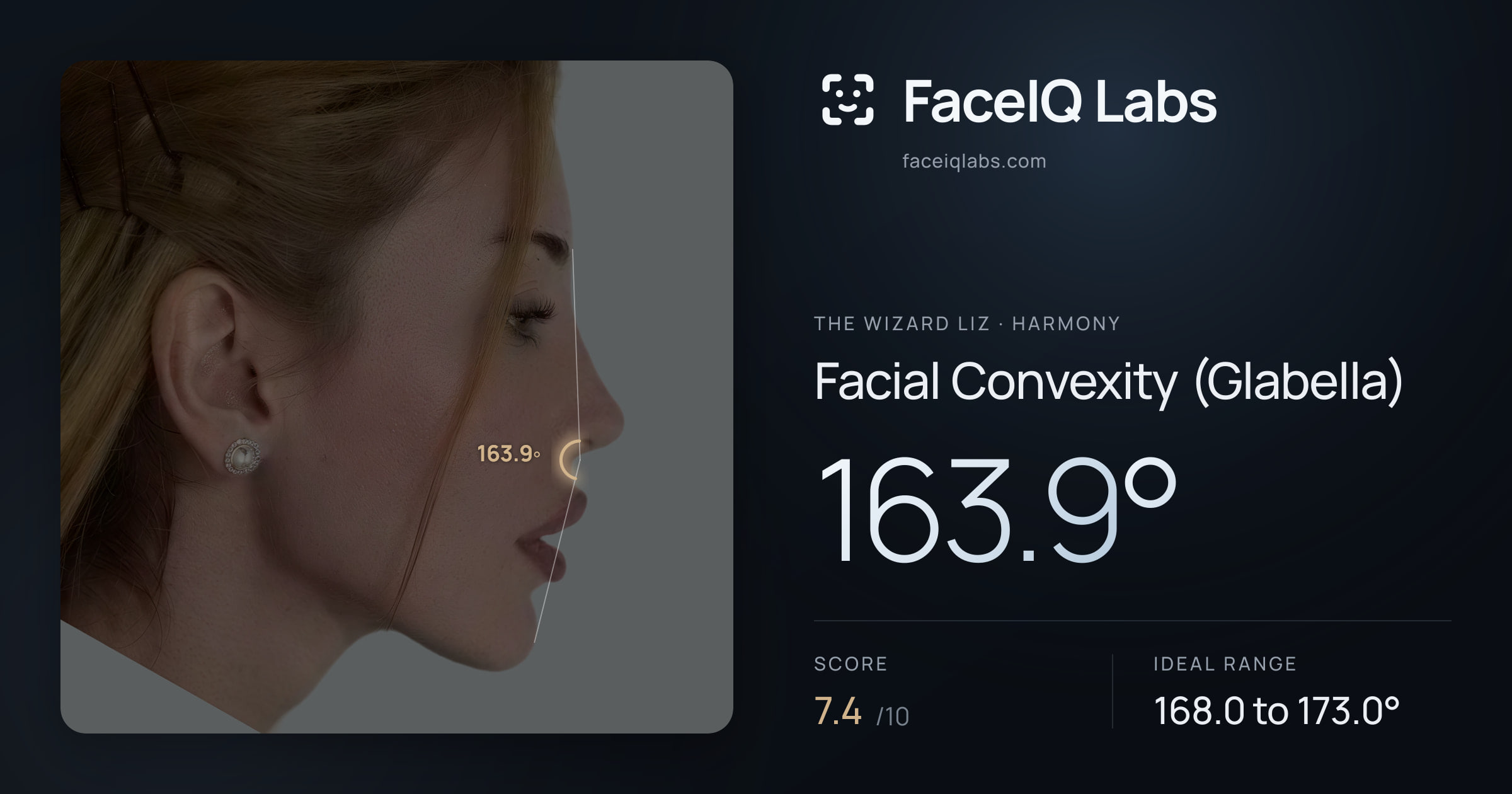 The Wizard Liz Facial Convexity (Glabella): 163.9°, drawn on the photo