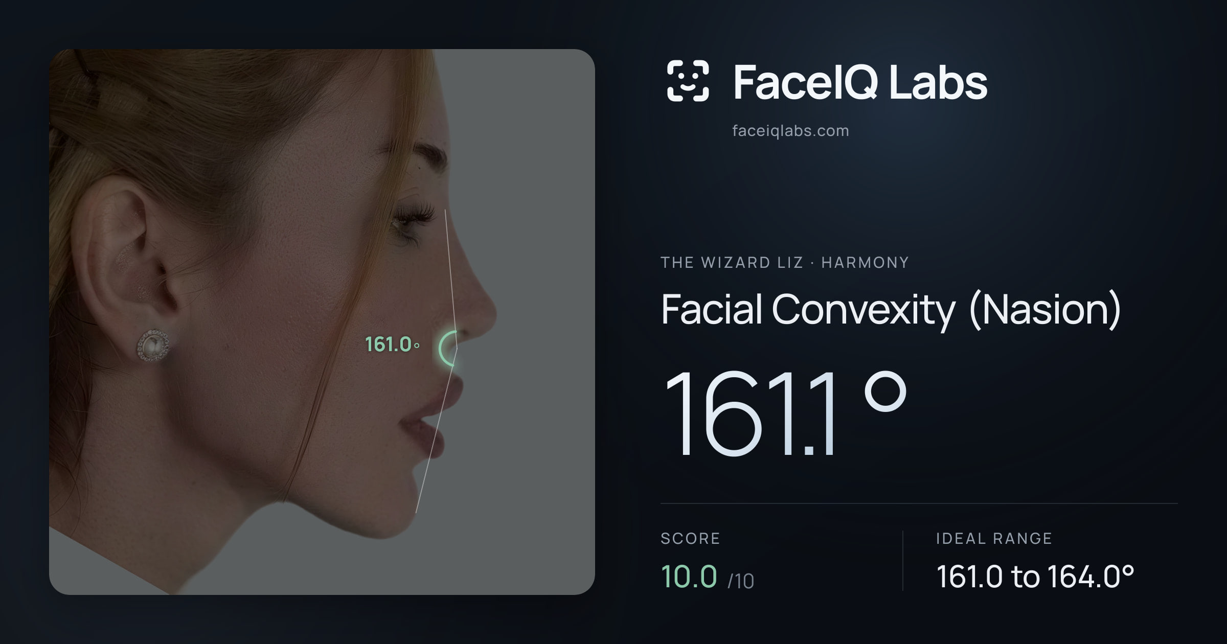 The Wizard Liz Facial Convexity (Nasion): 161.1°, drawn on the photo