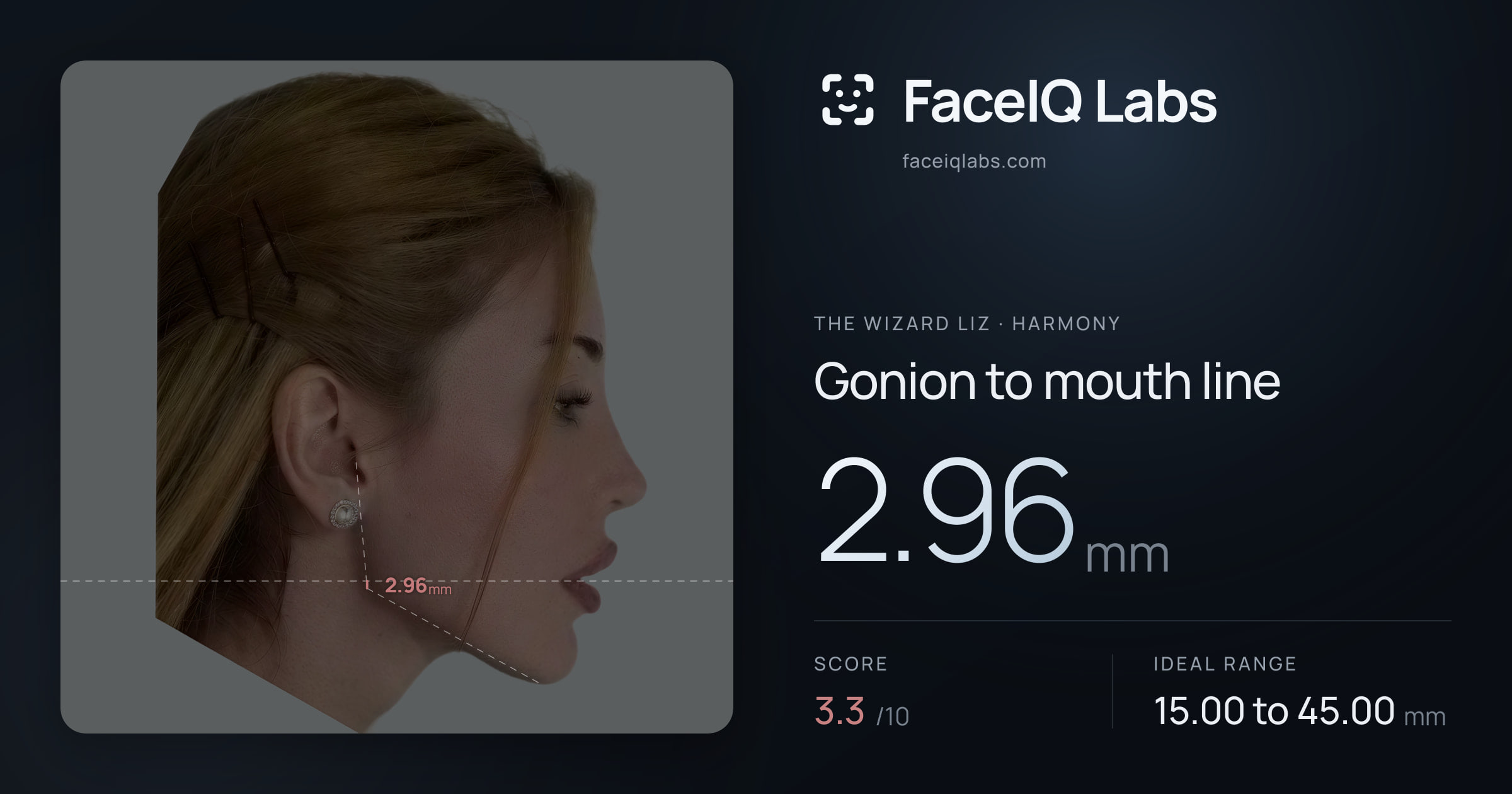 The Wizard Liz Gonion to mouth line: 2.96mm, drawn on the photo