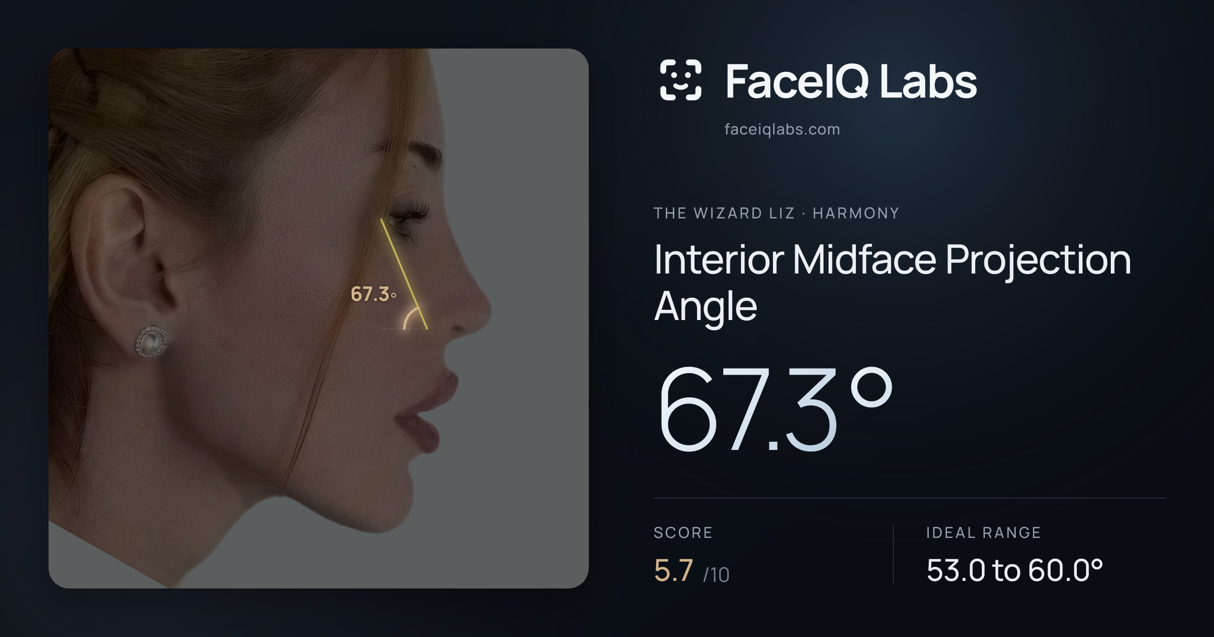 The Wizard Liz Interior Midface Projection Angle: 67.3°, drawn on the photo