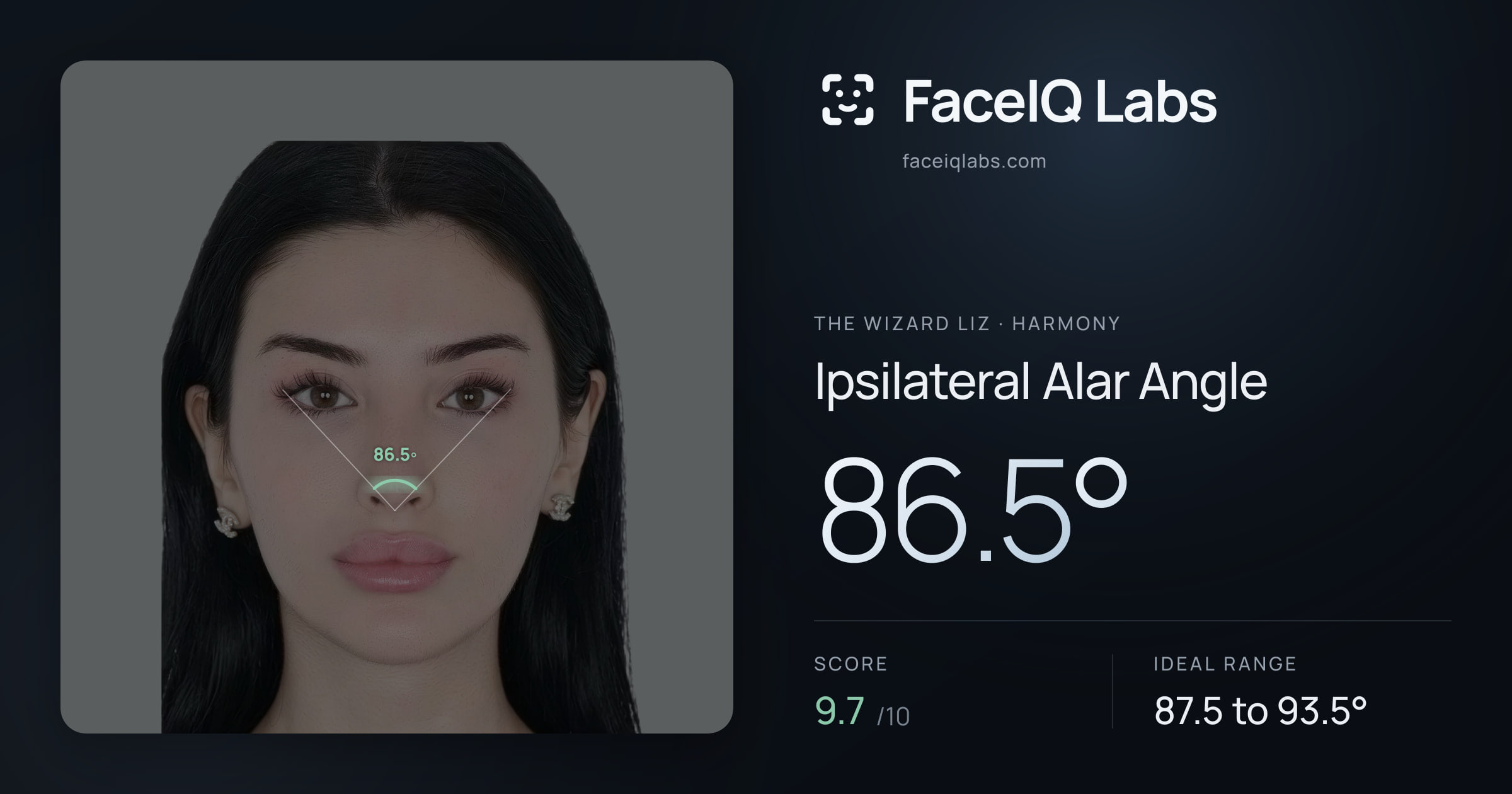 The Wizard Liz Ipsilateral Alar Angle: 86.5°, drawn on the photo