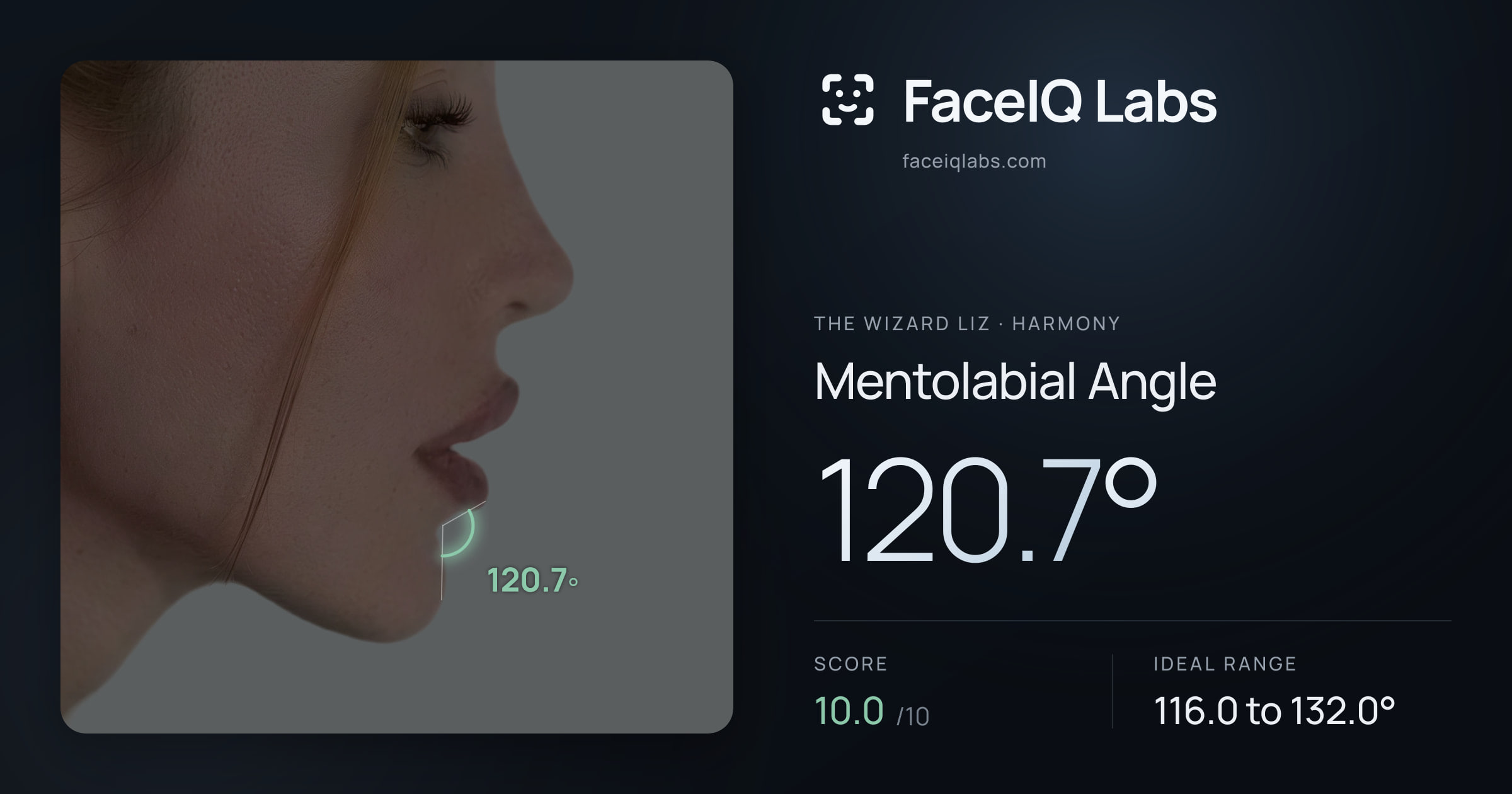 The Wizard Liz Mentolabial Angle: 120.7°, drawn on the photo