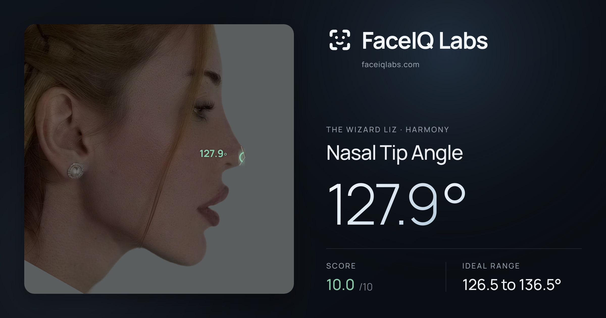 The Wizard Liz Nasal Tip Angle: 127.9°, drawn on the photo