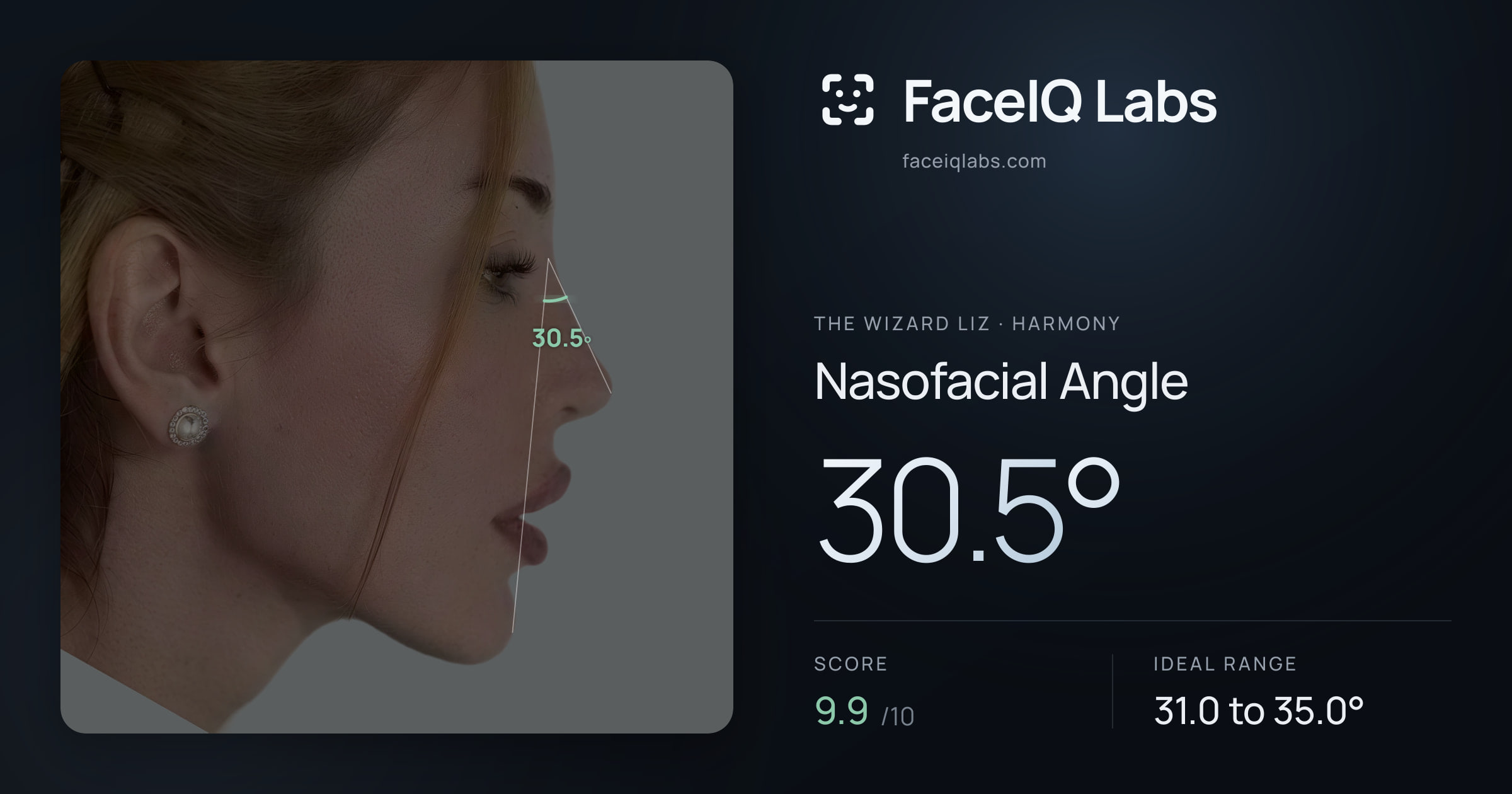 The Wizard Liz Nasofacial Angle: 30.5°, drawn on the photo