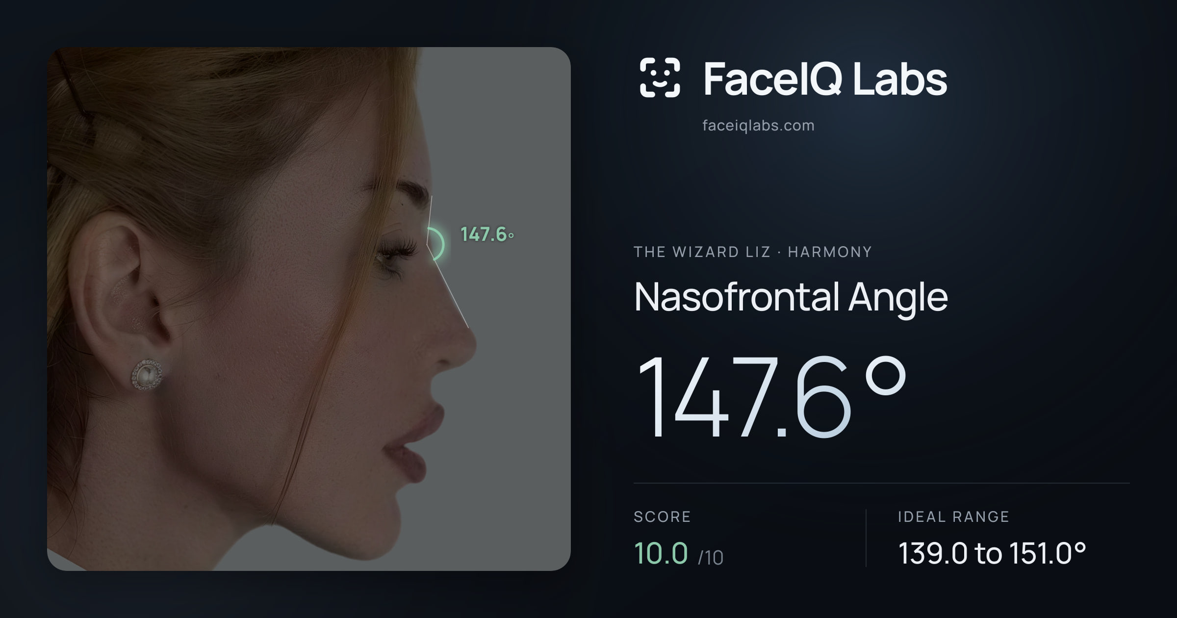 The Wizard Liz Nasofrontal Angle: 147.6°, drawn on the photo