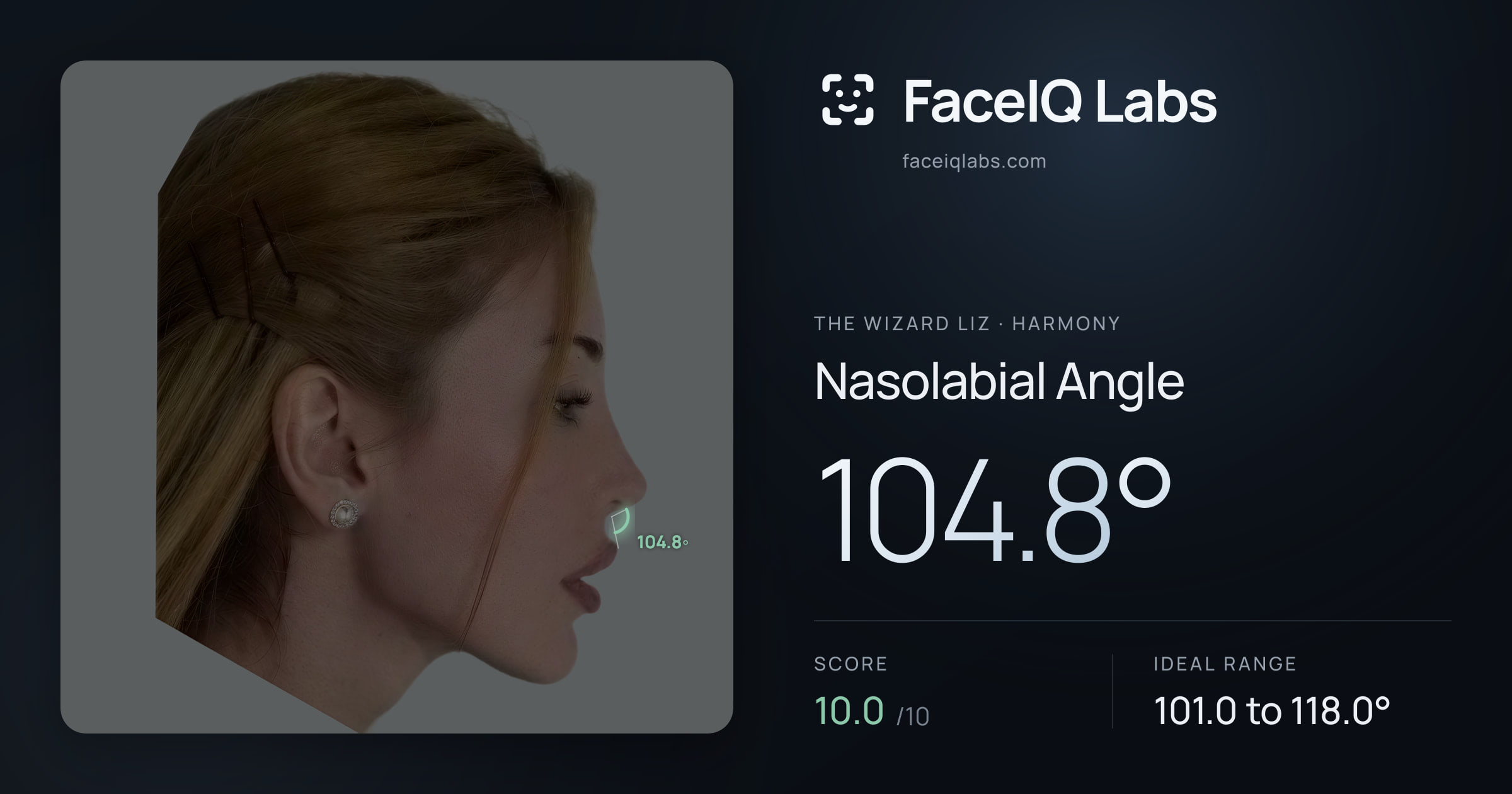 The Wizard Liz Nasolabial Angle: 104.8°, drawn on the photo
