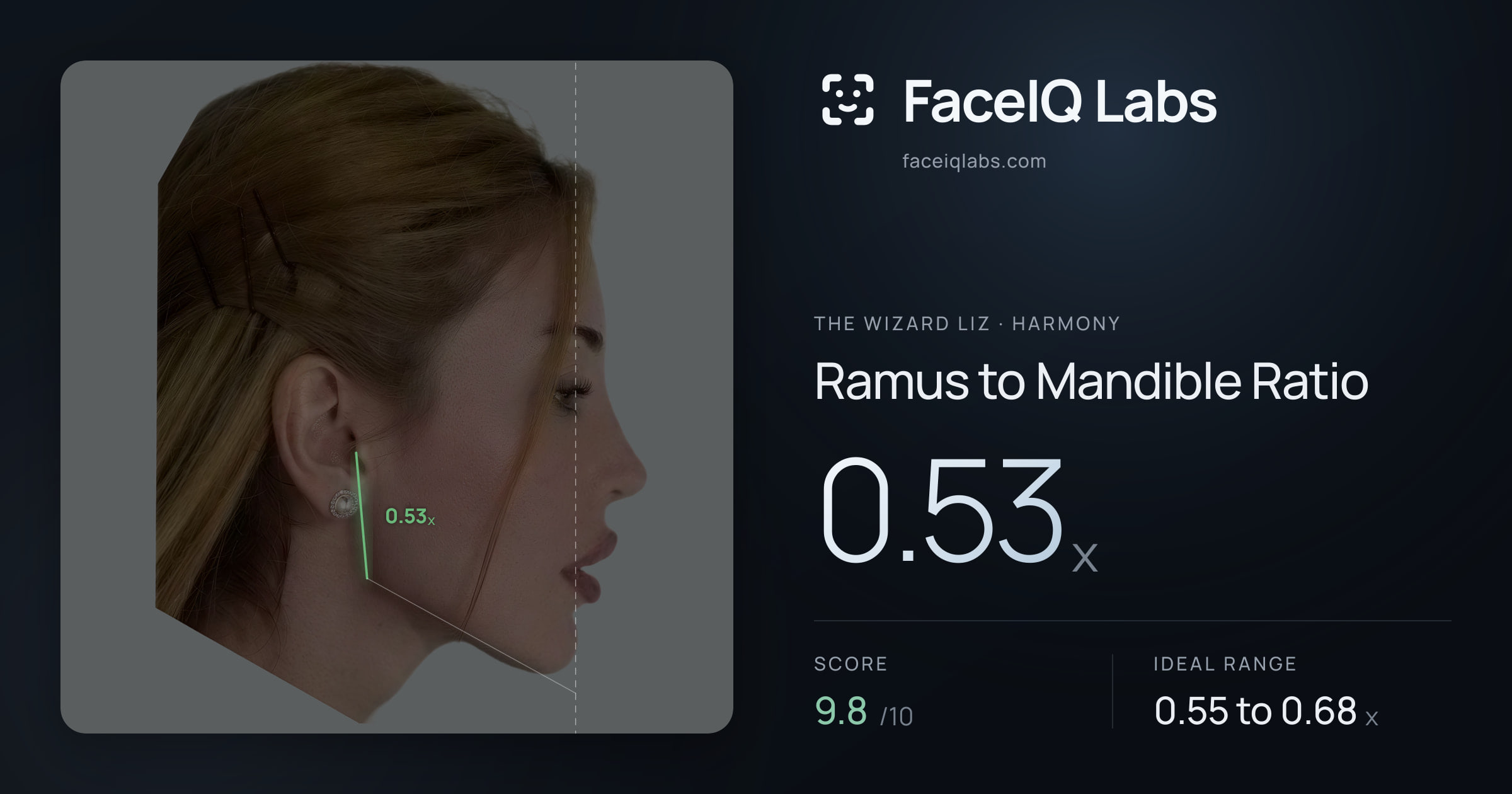 The Wizard Liz Ramus to Mandible Ratio: 0.53x, drawn on the photo