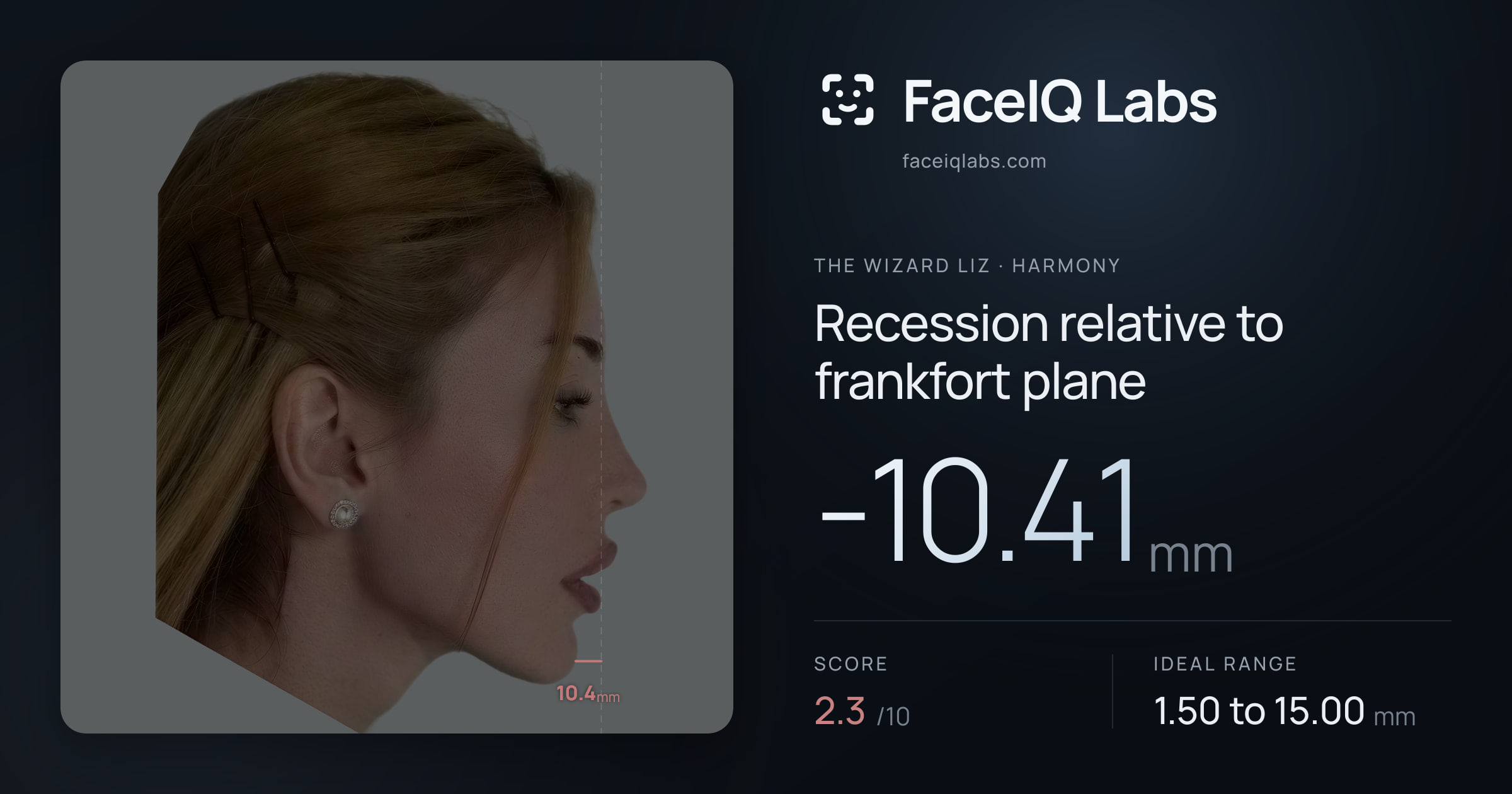 The Wizard Liz Recession relative to frankfort plane: -10.41mm, drawn on the photo
