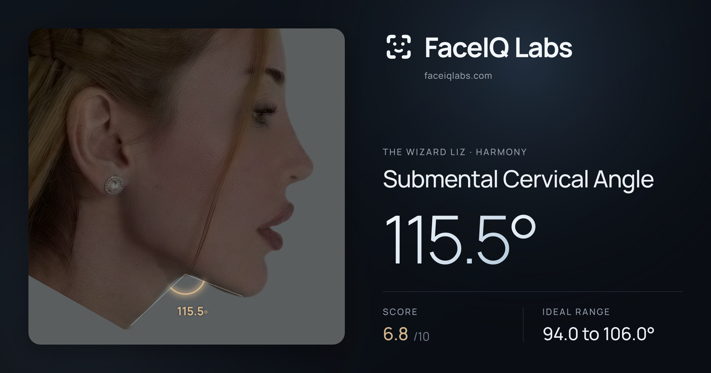 The Wizard Liz Submental Cervical Angle: 115.5°, drawn on the photo
