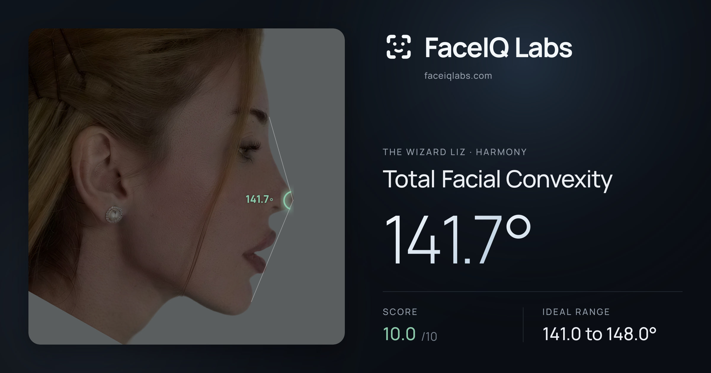 The Wizard Liz Total Facial Convexity: 141.7°, drawn on the photo