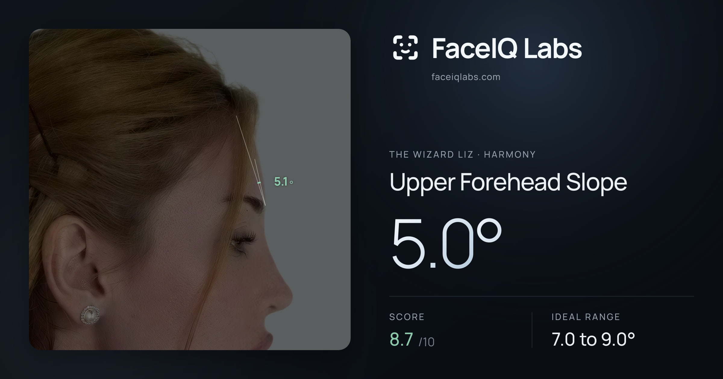 The Wizard Liz Upper Forehead Slope: 5.0°, drawn on the photo