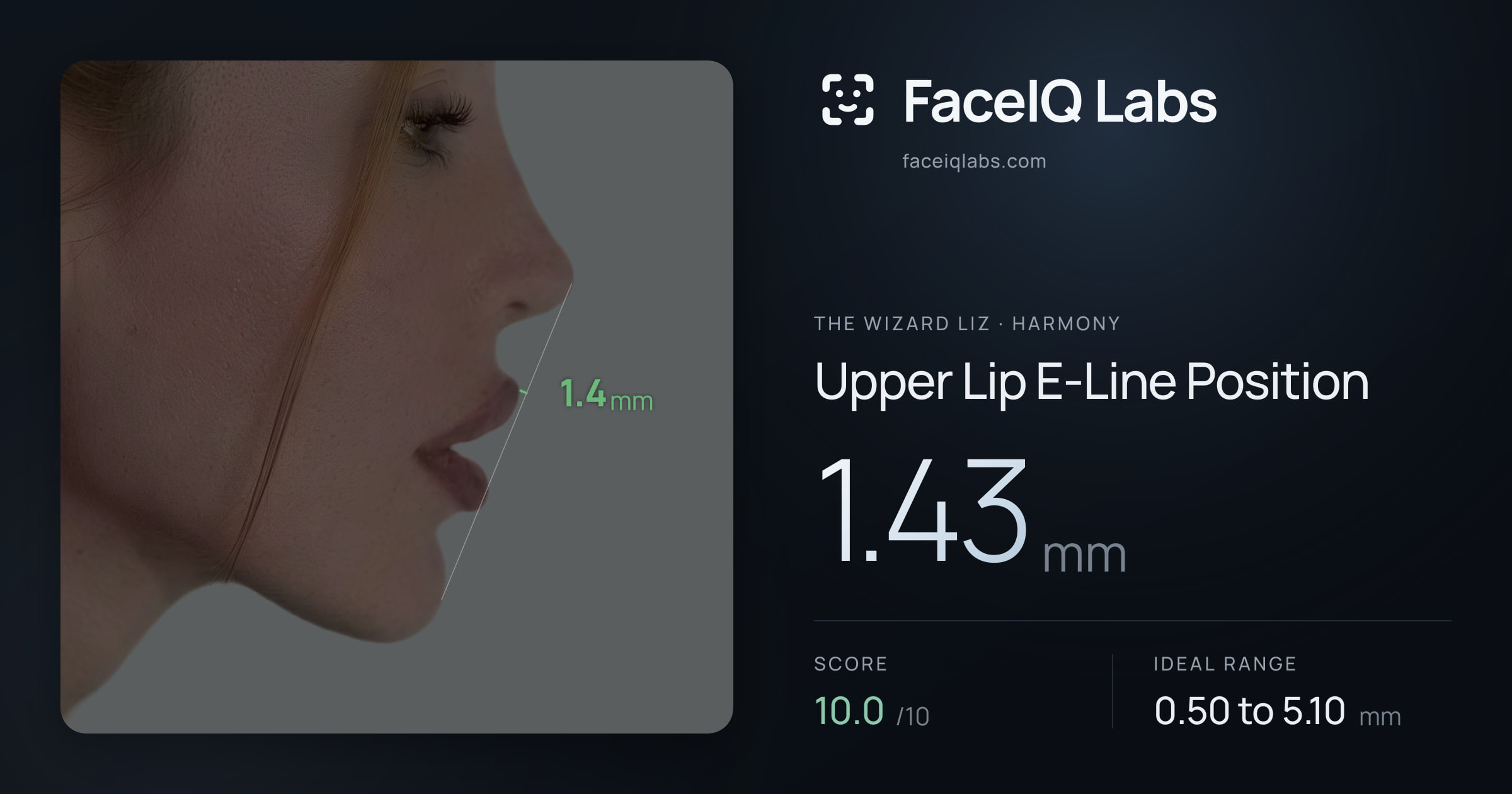 The Wizard Liz Upper Lip E-Line Position: 1.43mm, drawn on the photo