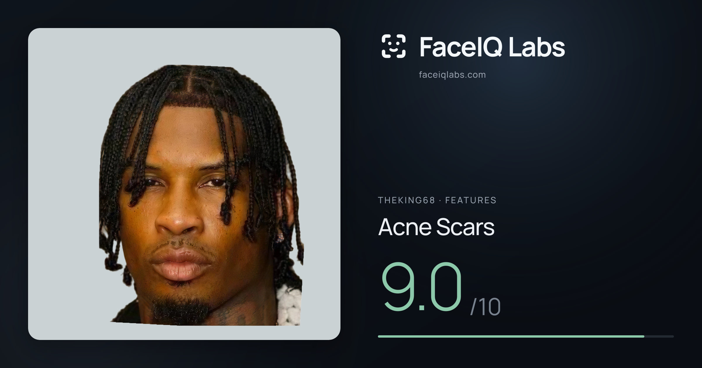 Theking68 Acne Scars: 9.0/10, drawn on the photo