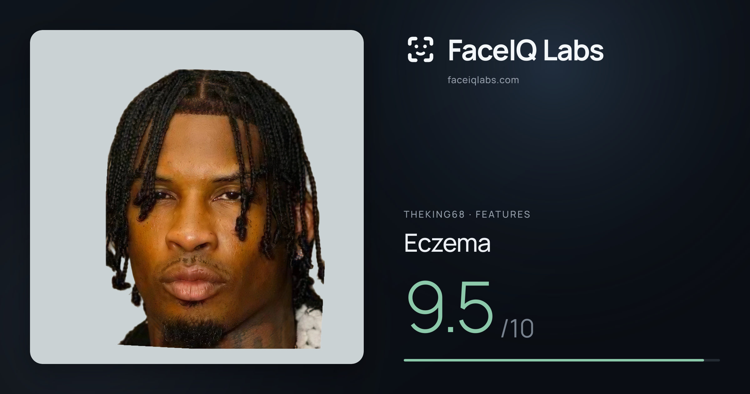 Theking68 Eczema: 9.5/10, drawn on the photo