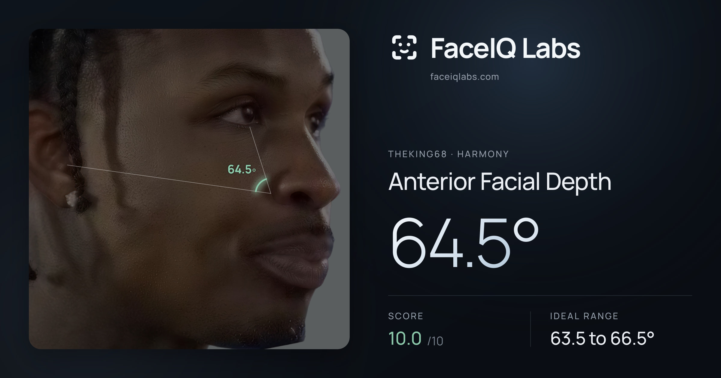 Theking68 Anterior Facial Depth: 64.5°, drawn on the photo