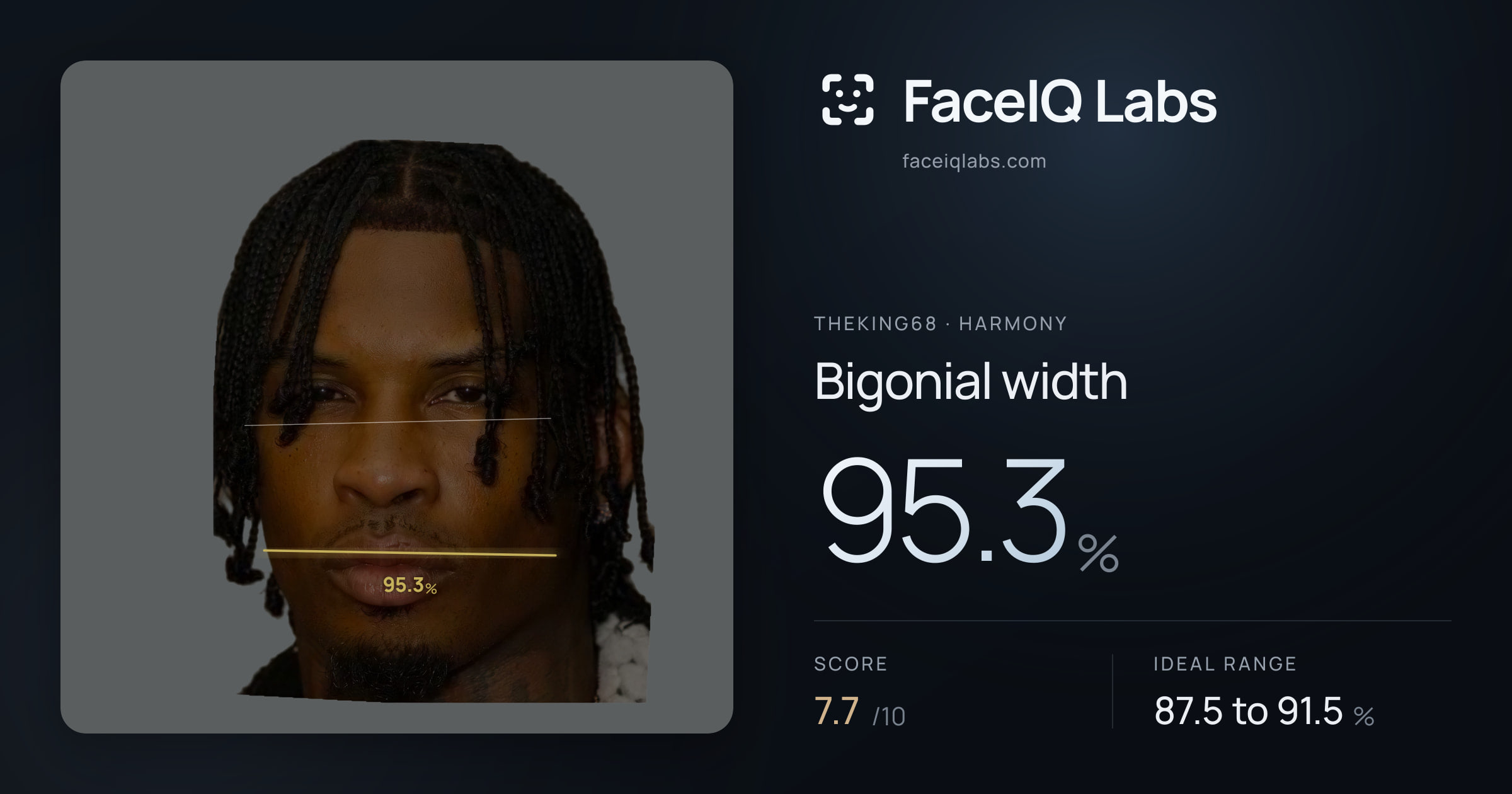 Theking68 Bigonial width: 95.3%, drawn on the photo