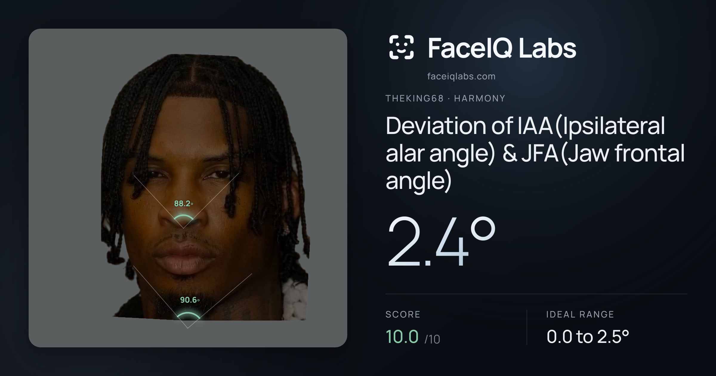 Theking68 Deviation of IAA(Ipsilateral alar angle) & JFA(Jaw frontal angle): 2.4°, drawn on the photo