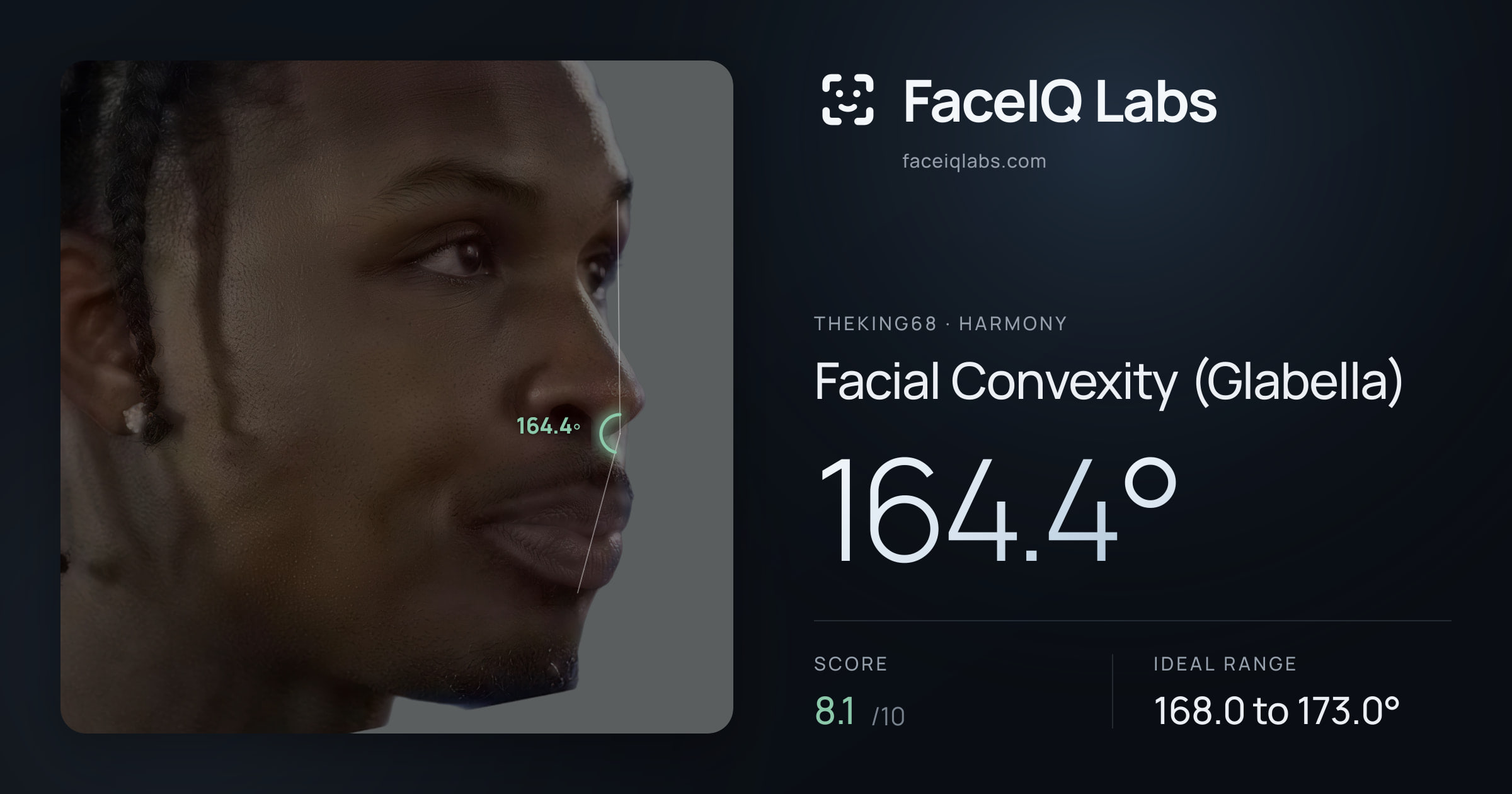 Theking68 Facial Convexity (Glabella): 164.4°, drawn on the photo
