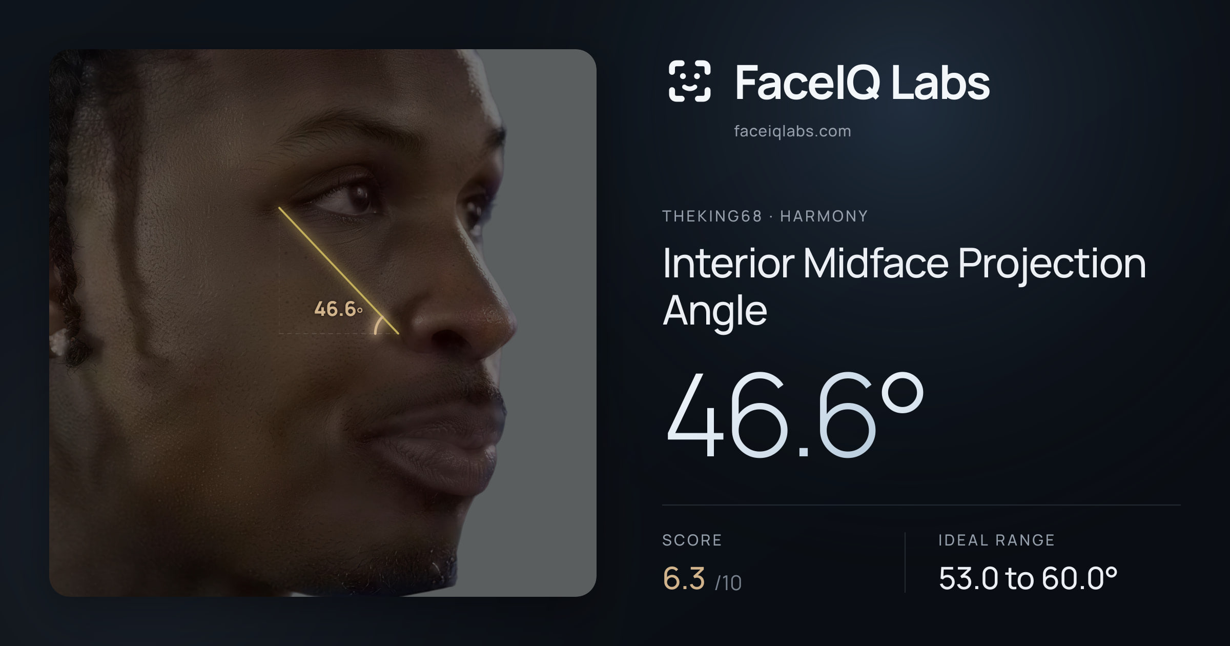 Theking68 Interior Midface Projection Angle: 46.6°, drawn on the photo
