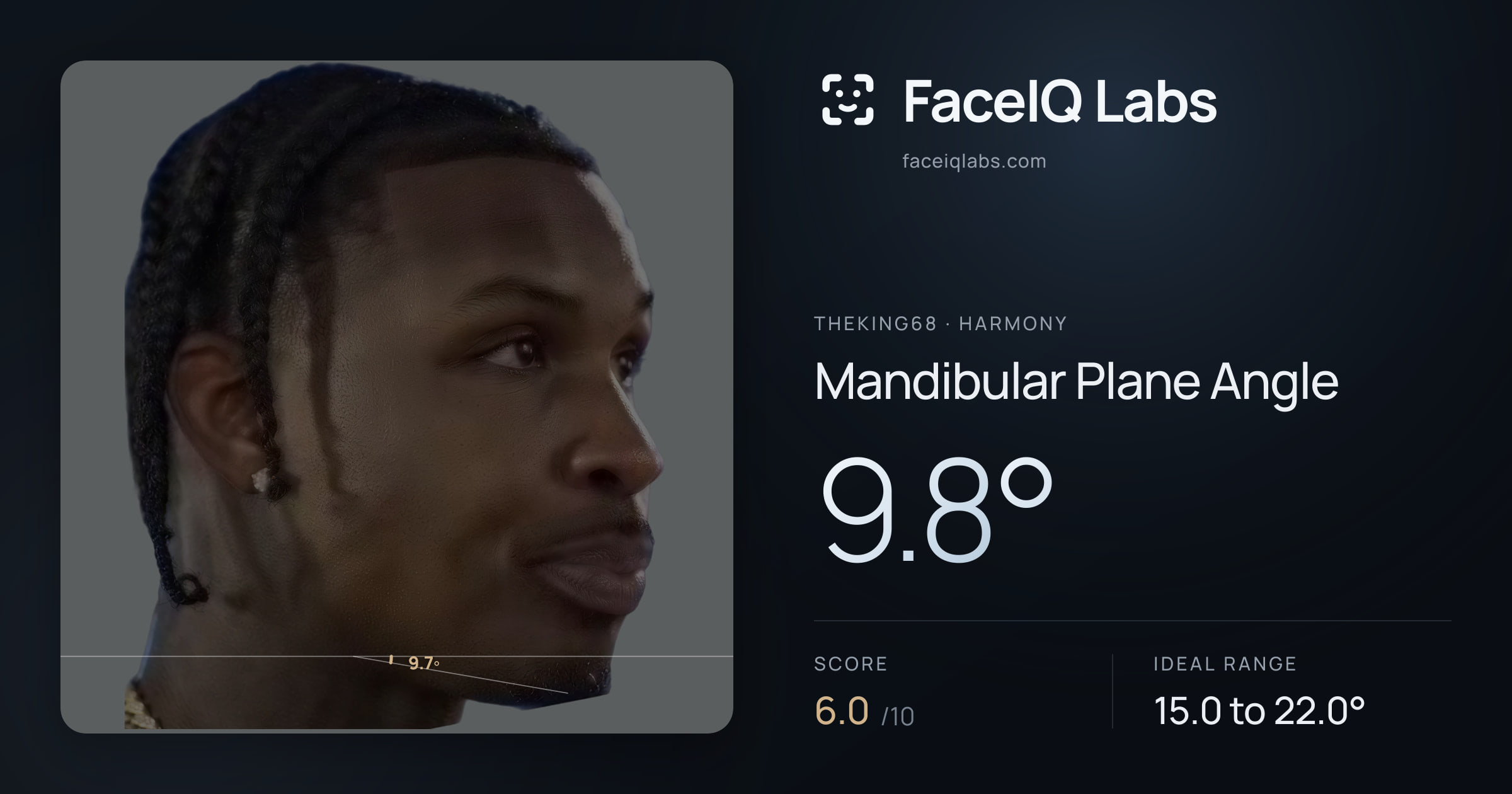 Theking68 Mandibular Plane Angle: 9.8°, drawn on the photo