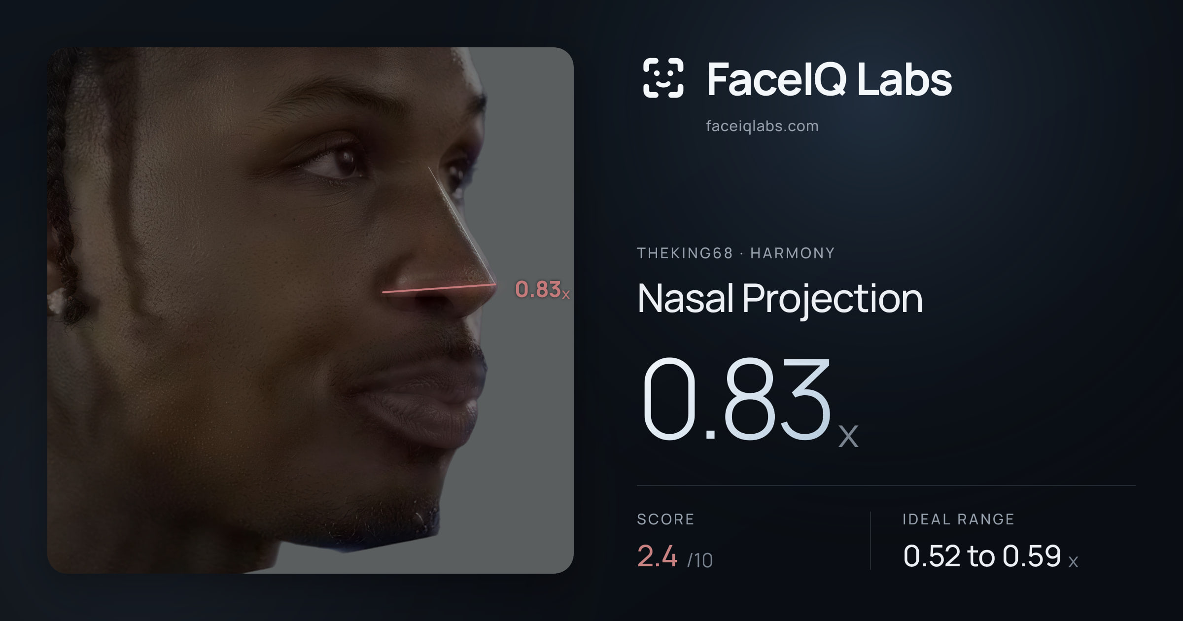 Theking68 Nasal Projection: 0.83x, drawn on the photo