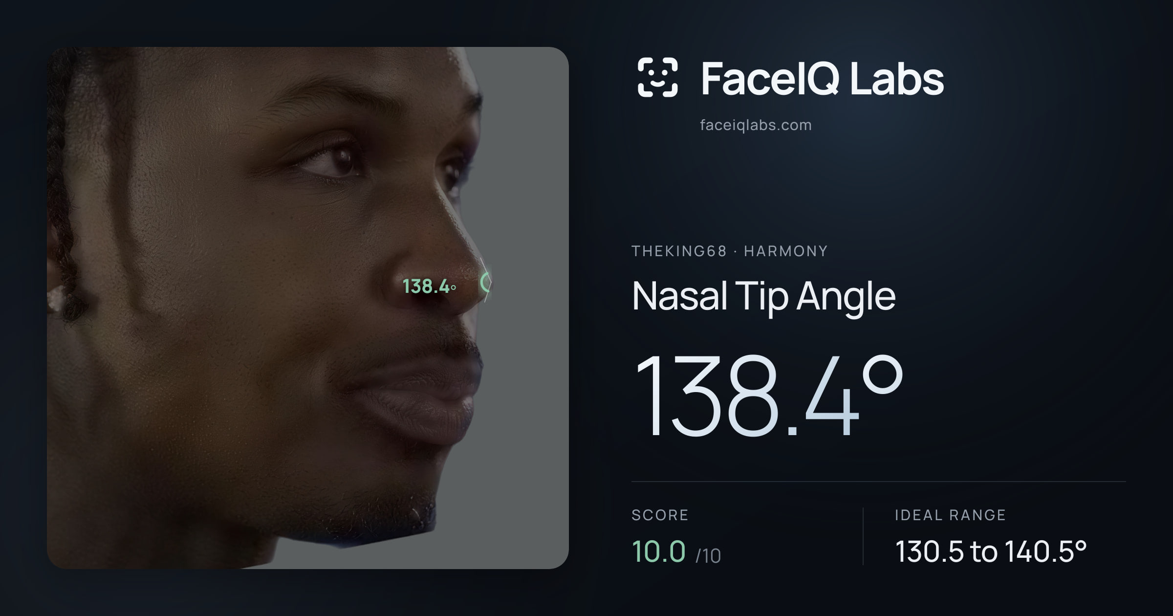 Theking68 Nasal Tip Angle: 138.4°, drawn on the photo
