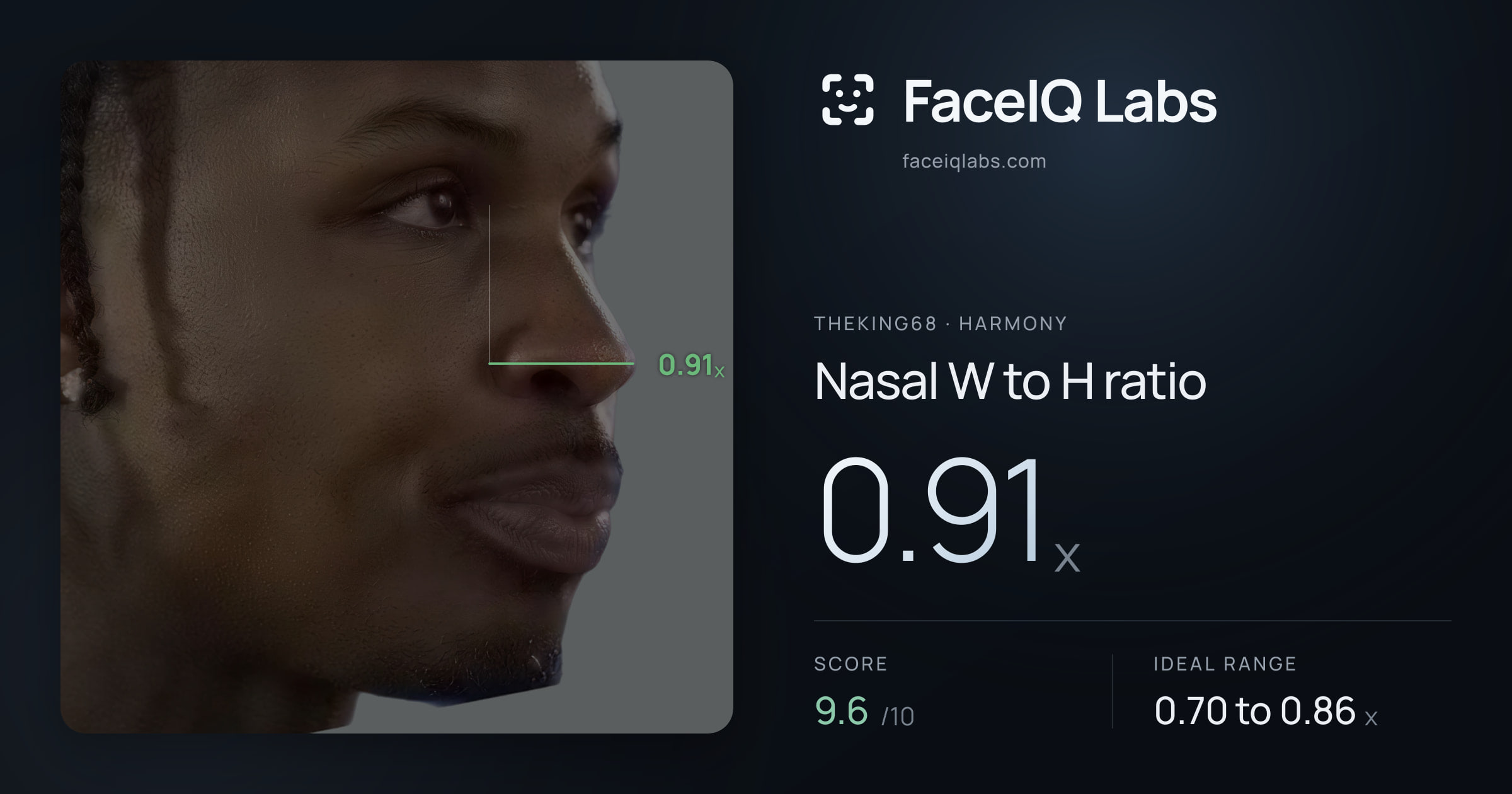 Theking68 Nasal W to H ratio: 0.91x, drawn on the photo