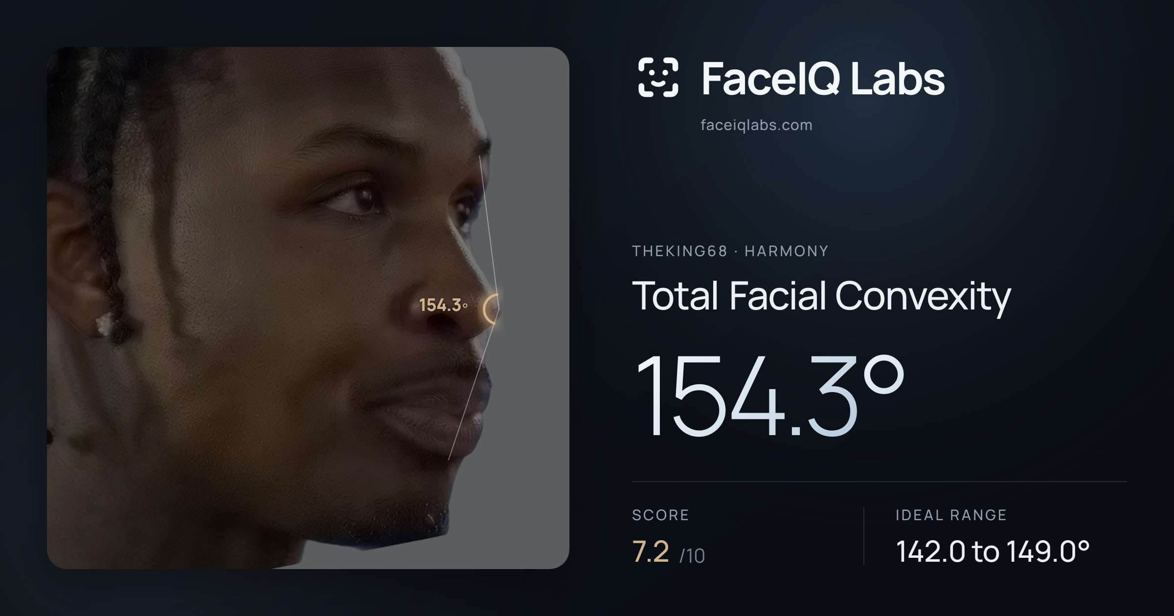 Theking68 Total Facial Convexity: 154.3°, drawn on the photo