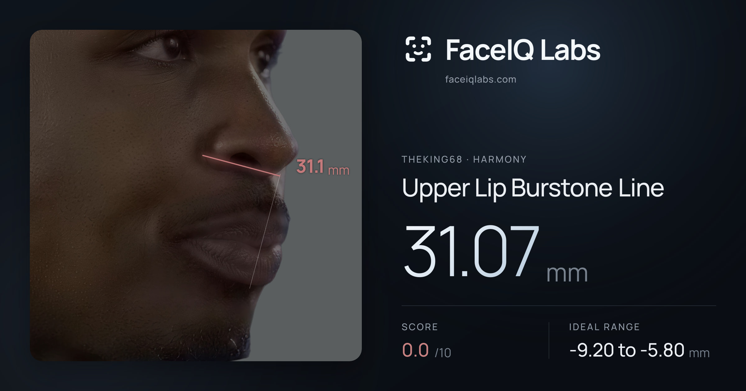 Theking68 Upper Lip Burstone Line: 31.07mm, drawn on the photo