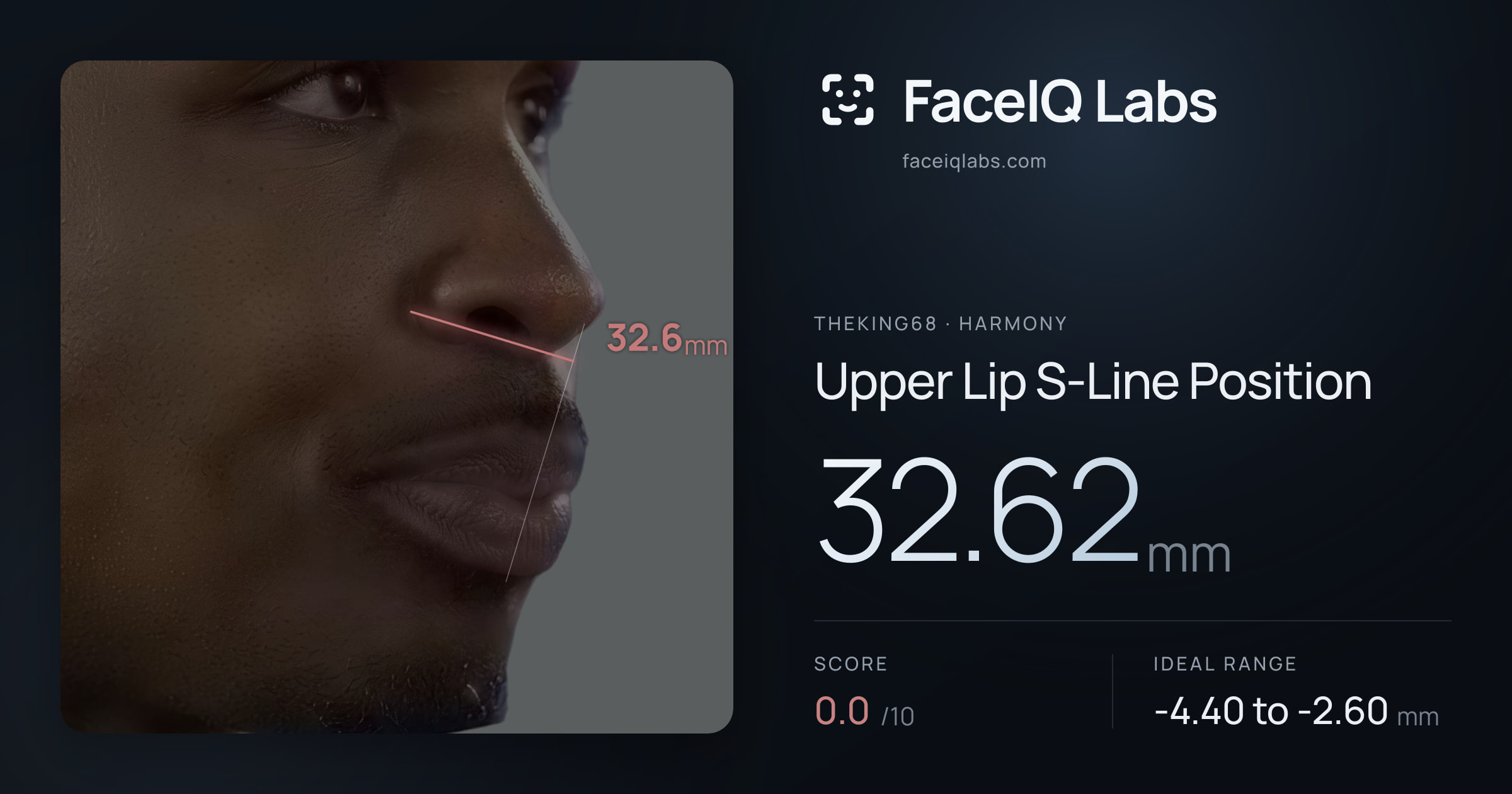 Theking68 Upper Lip S-Line Position: 32.62mm, drawn on the photo