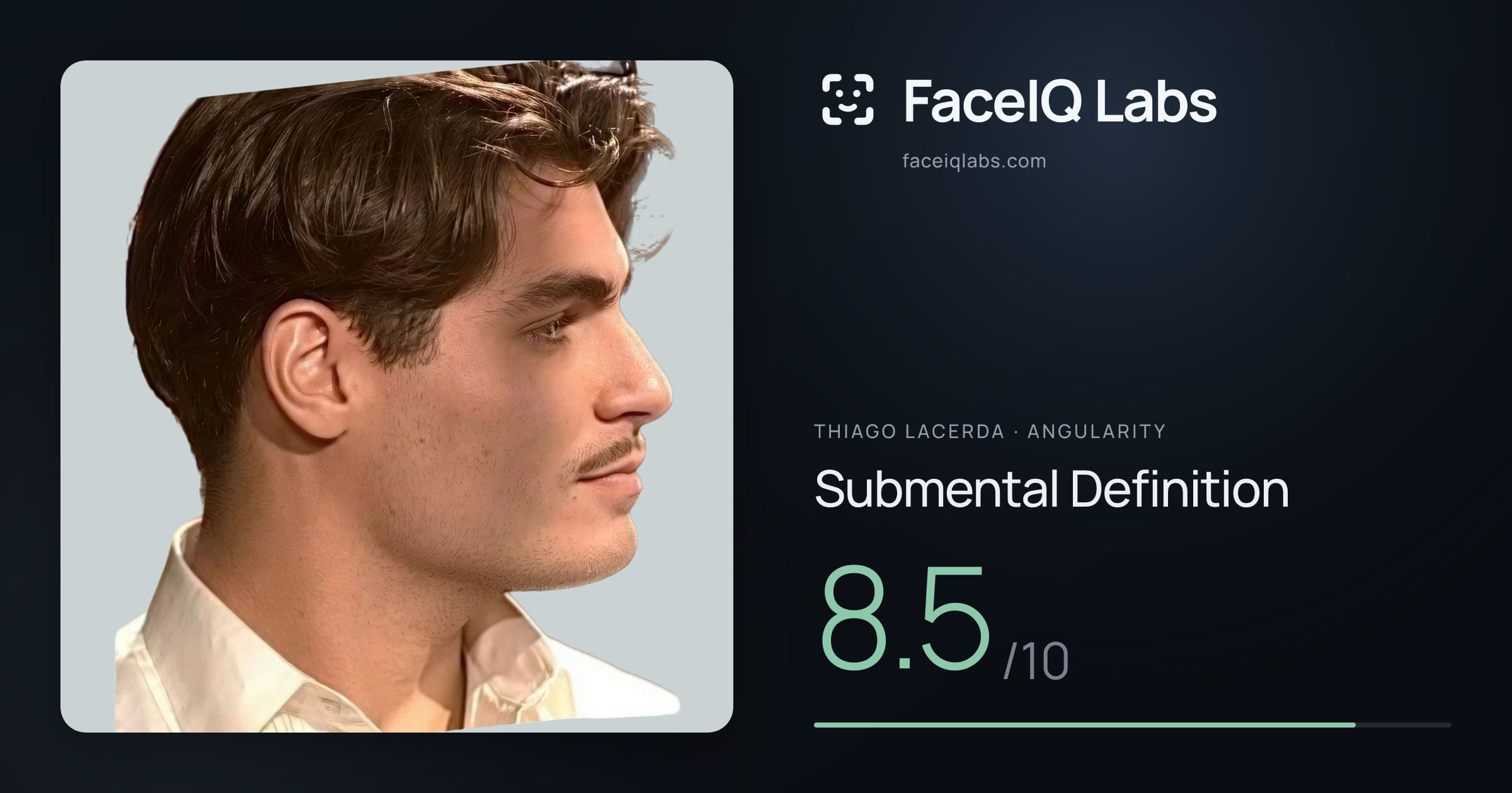 Thiago Lacerda Submental Definition: 8.5/10, drawn on the photo