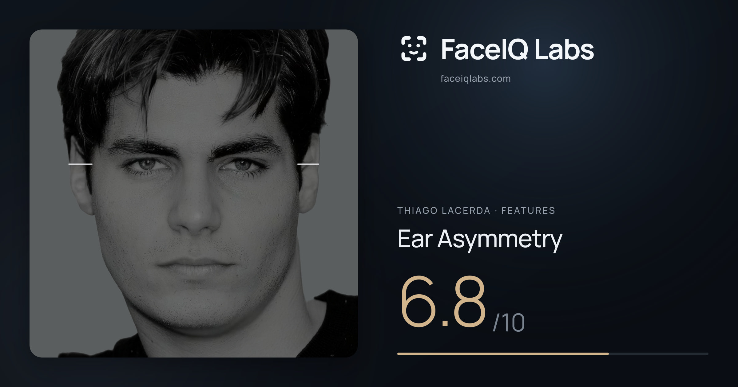 Thiago Lacerda Ear Asymmetry: 6.8/10, drawn on the photo