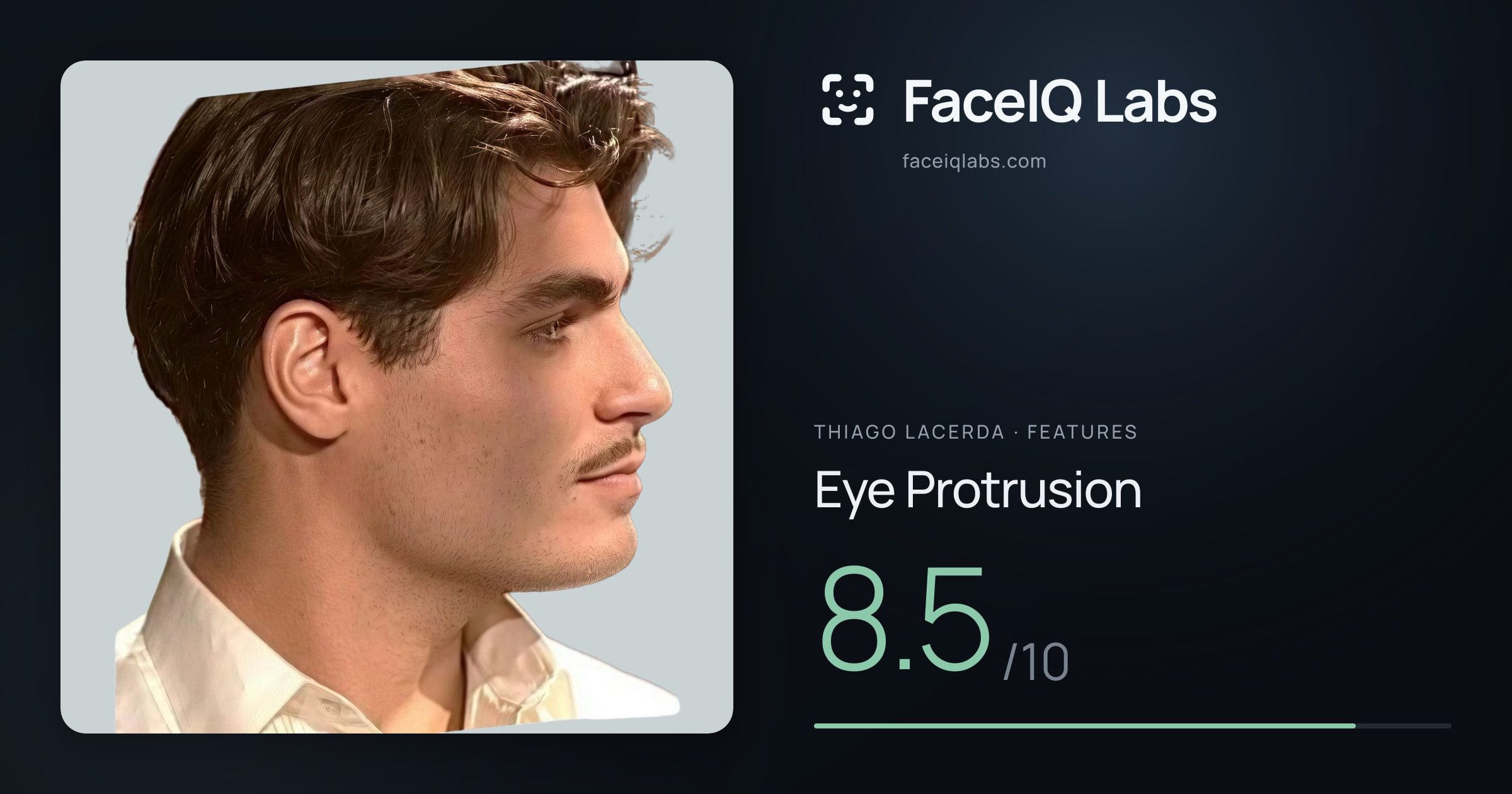 Thiago Lacerda Eye Protrusion: 8.5/10, drawn on the photo