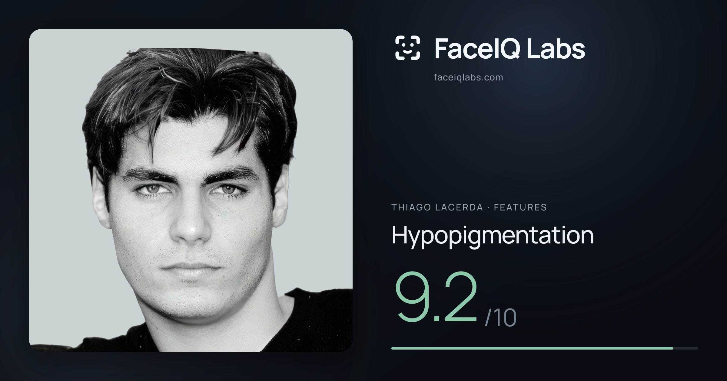 Thiago Lacerda Hypopigmentation: 9.2/10, drawn on the photo
