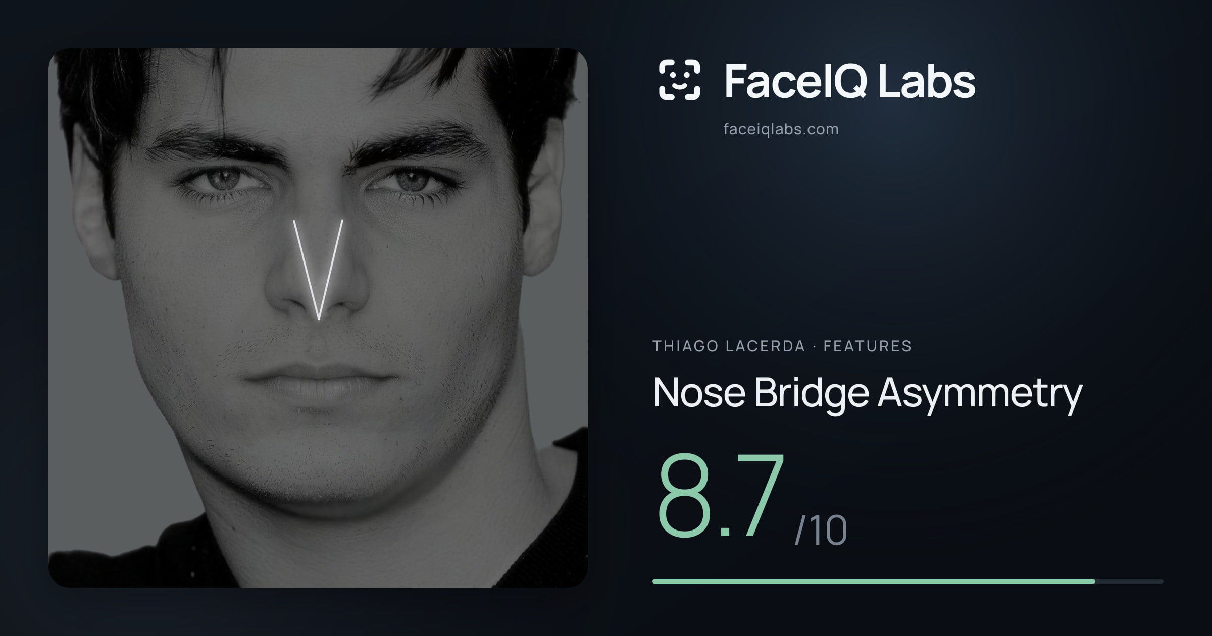 Thiago Lacerda Nose Bridge Asymmetry: 8.7/10, drawn on the photo