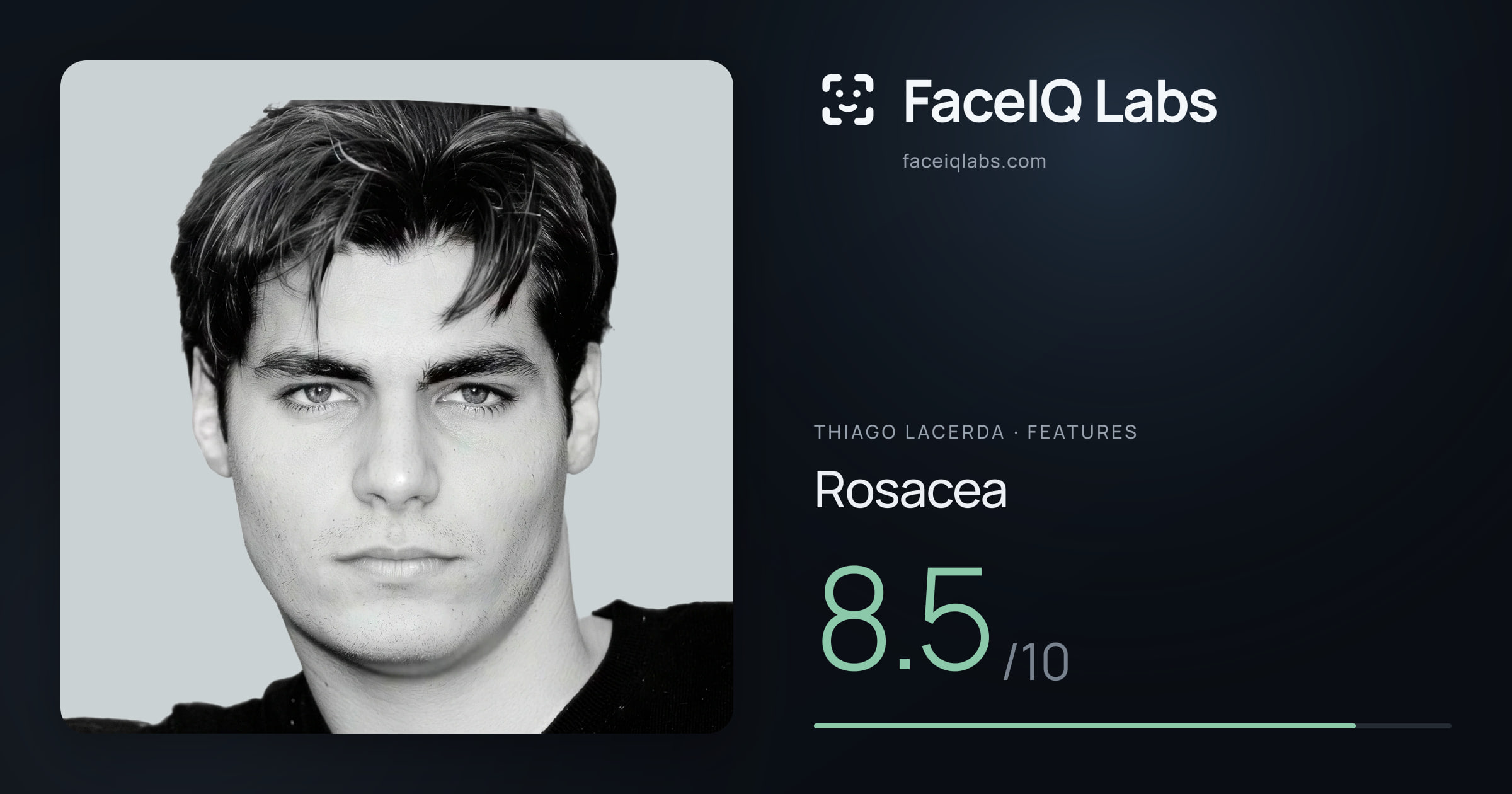Thiago Lacerda Rosacea: 8.5/10, drawn on the photo