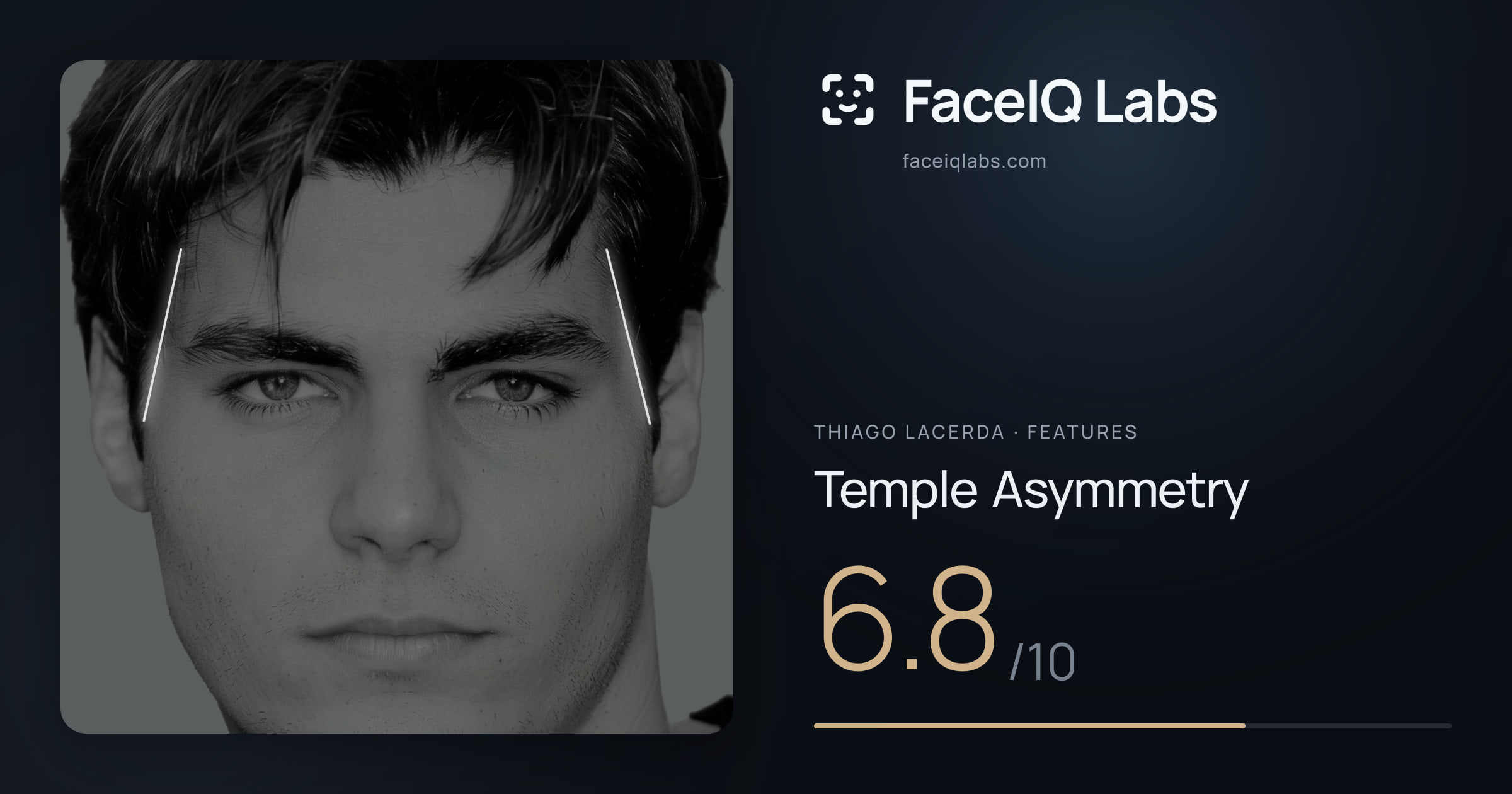 Thiago Lacerda Temple Asymmetry: 6.8/10, drawn on the photo