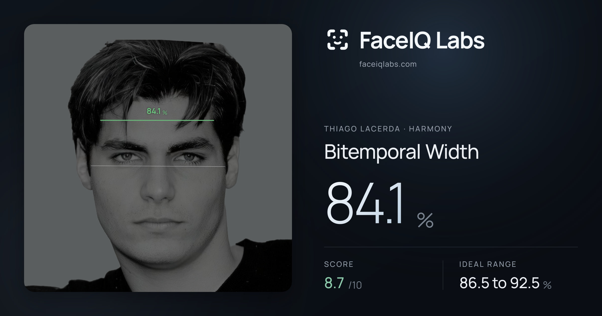 Thiago Lacerda Bitemporal Width: 84.1%, drawn on the photo