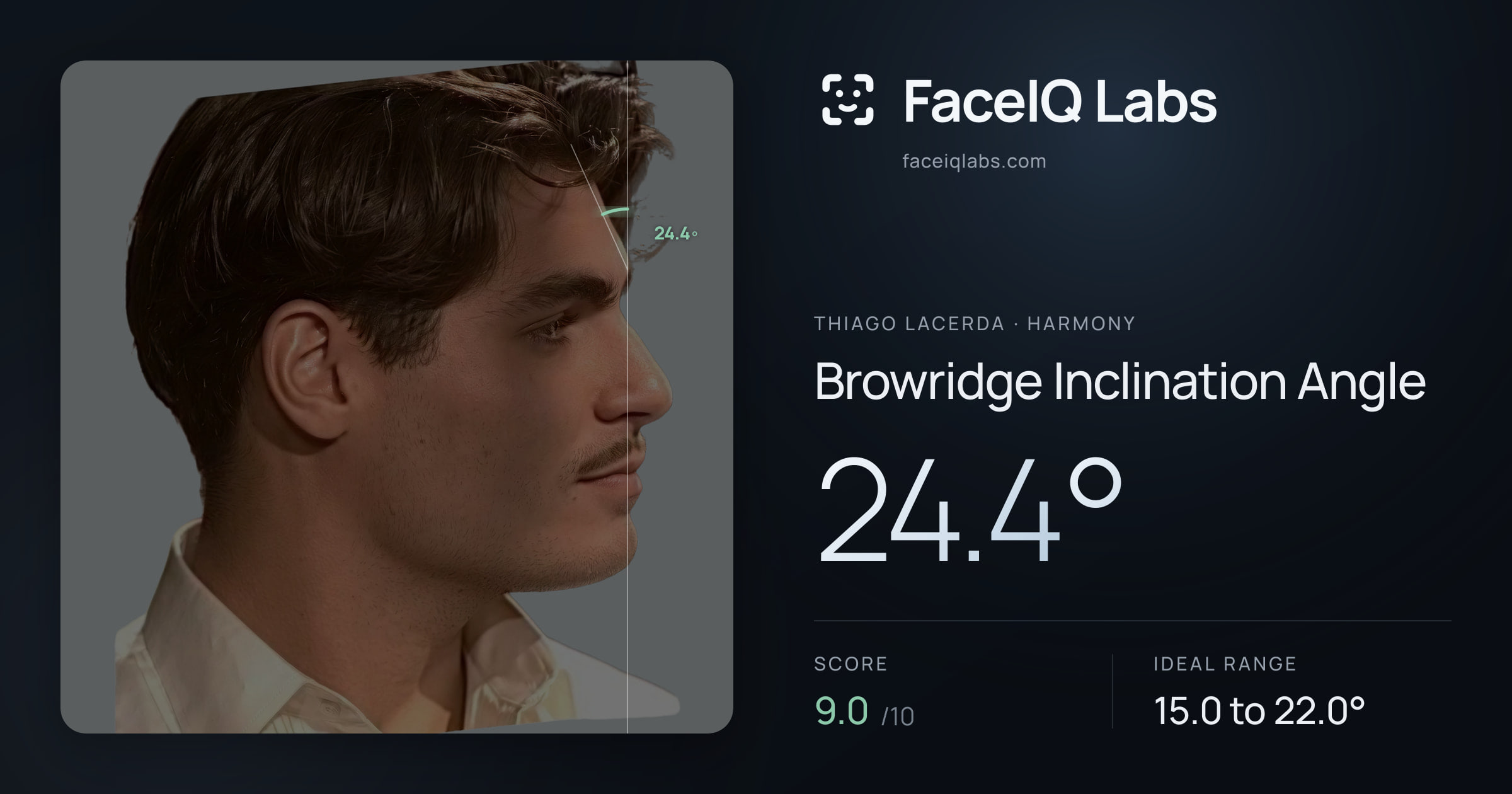 Thiago Lacerda Browridge Inclination Angle: 24.4°, drawn on the photo