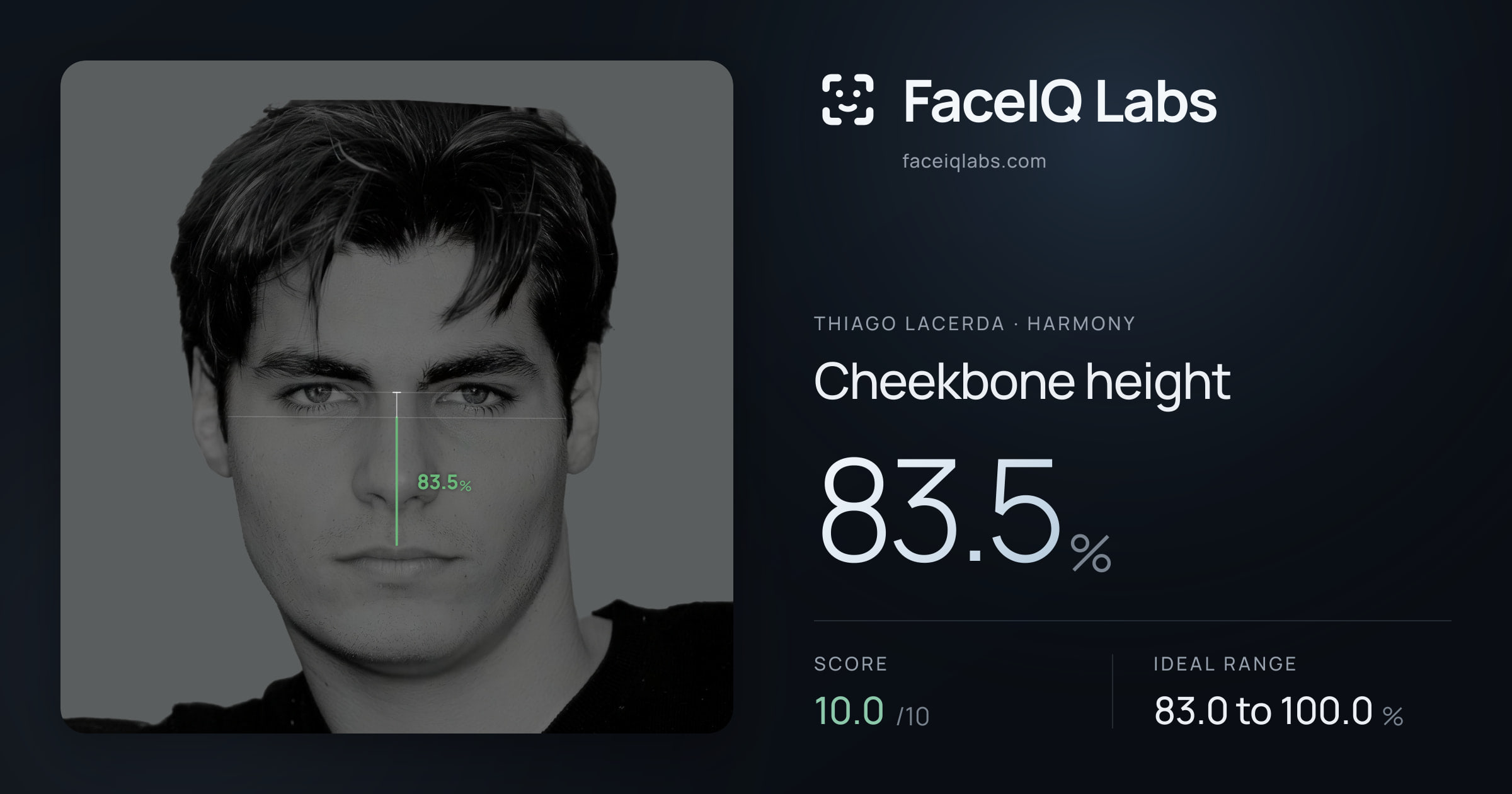 Thiago Lacerda Cheekbone height: 83.5%, drawn on the photo