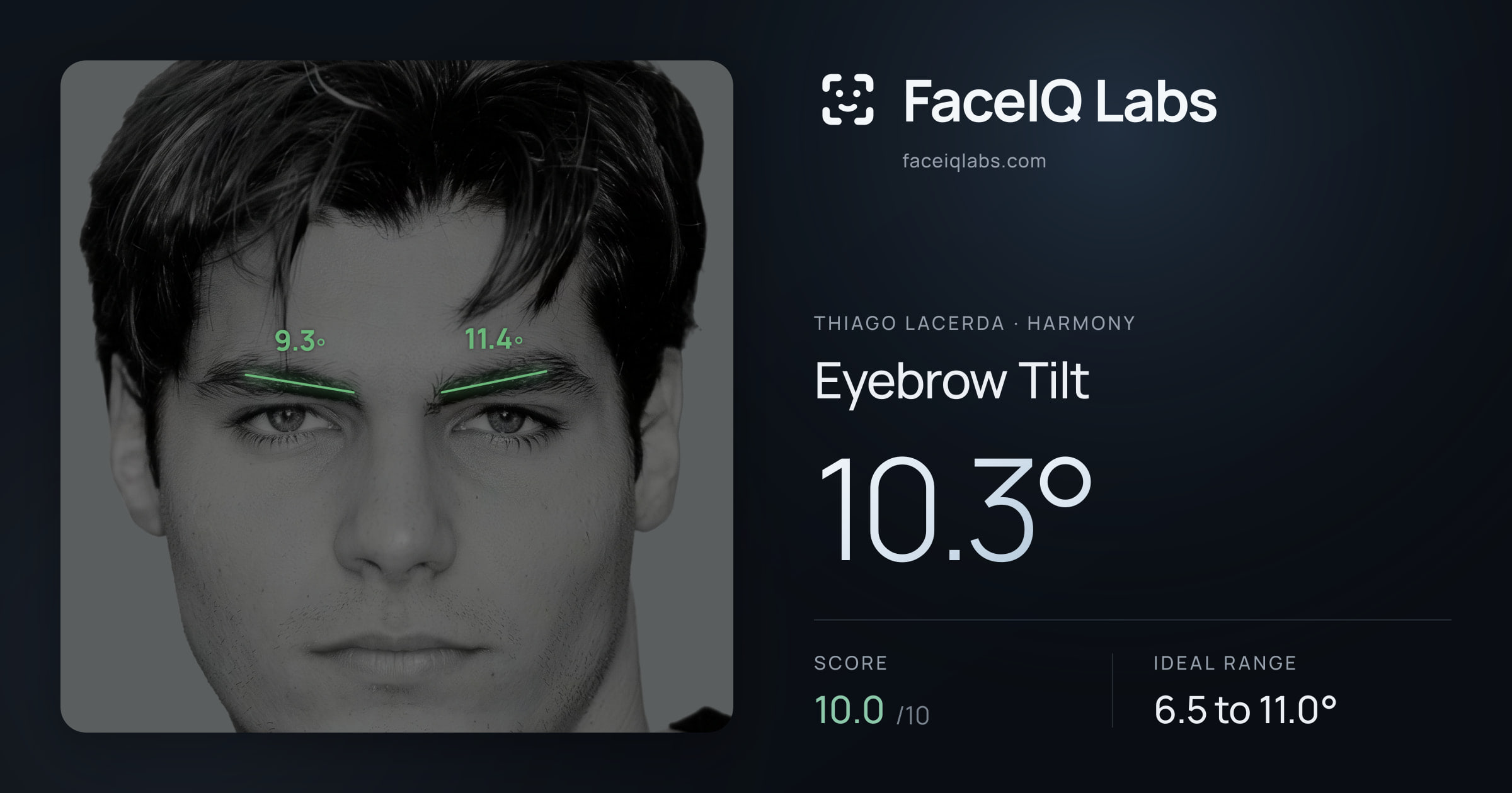 Thiago Lacerda Eyebrow Tilt: 10.3°, drawn on the photo
