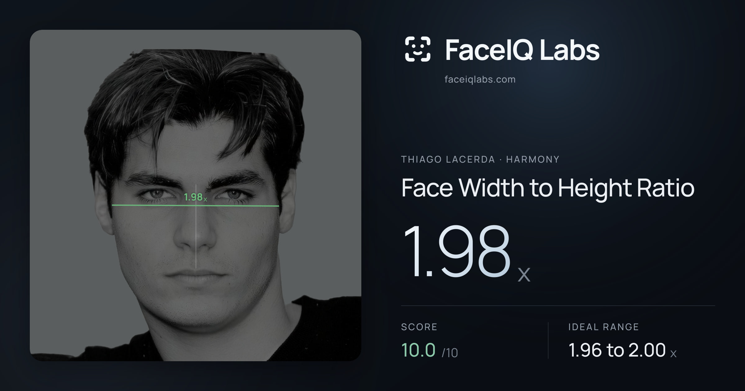 Thiago Lacerda Face Width to Height Ratio: 1.98x, drawn on the photo