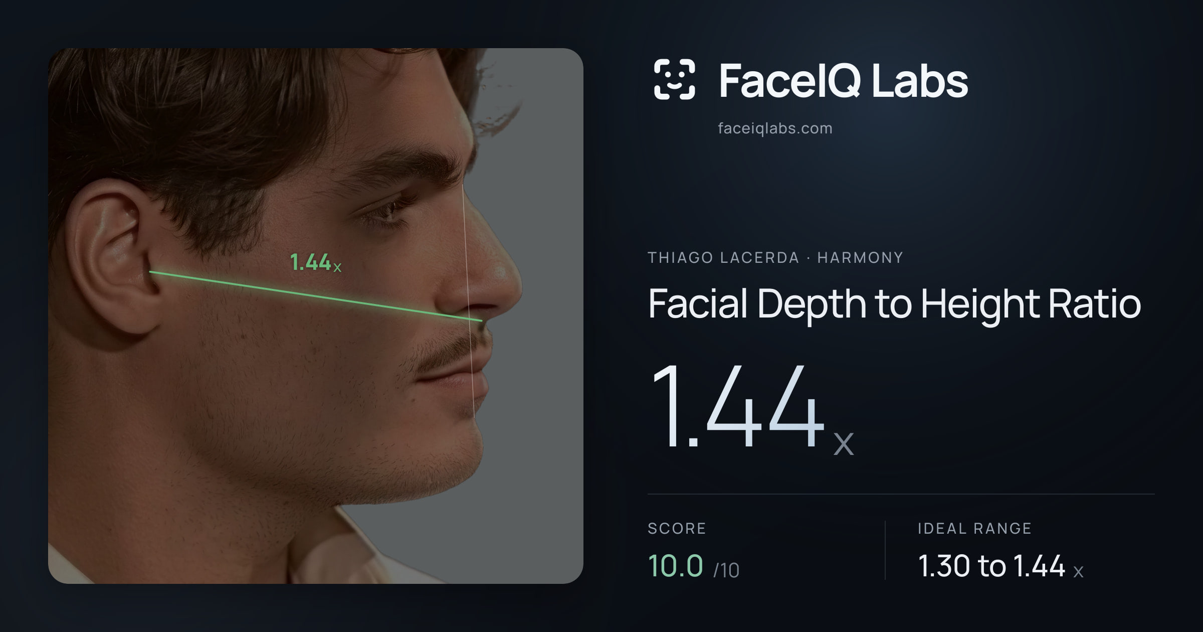 Thiago Lacerda Facial Depth to Height Ratio: 1.44x, drawn on the photo
