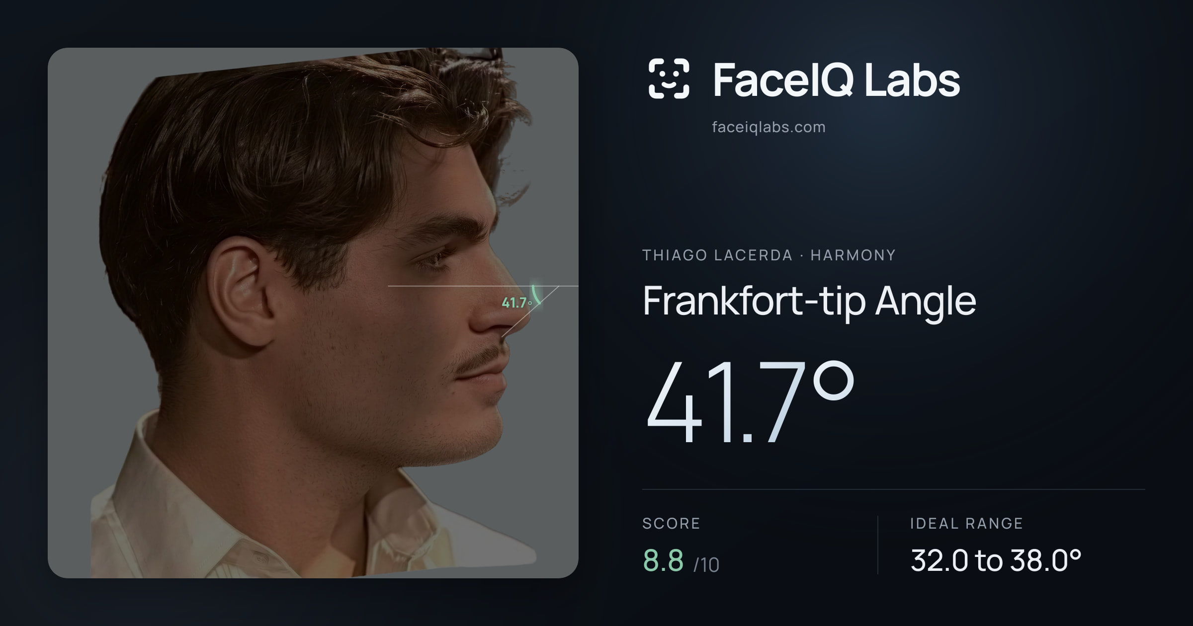 Thiago Lacerda Frankfort-tip Angle: 41.7°, drawn on the photo
