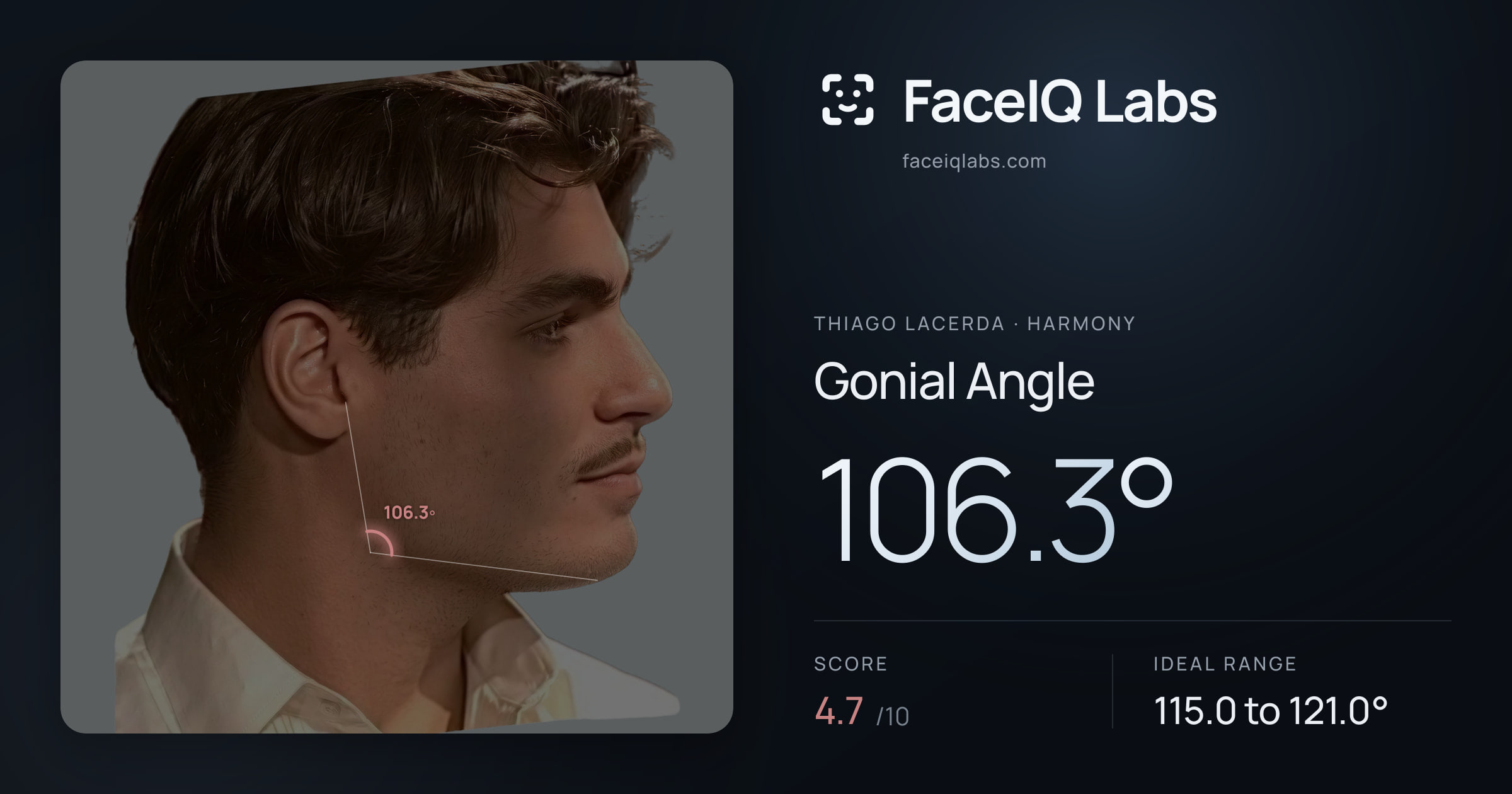 Thiago Lacerda Gonial Angle: 106.3°, drawn on the photo