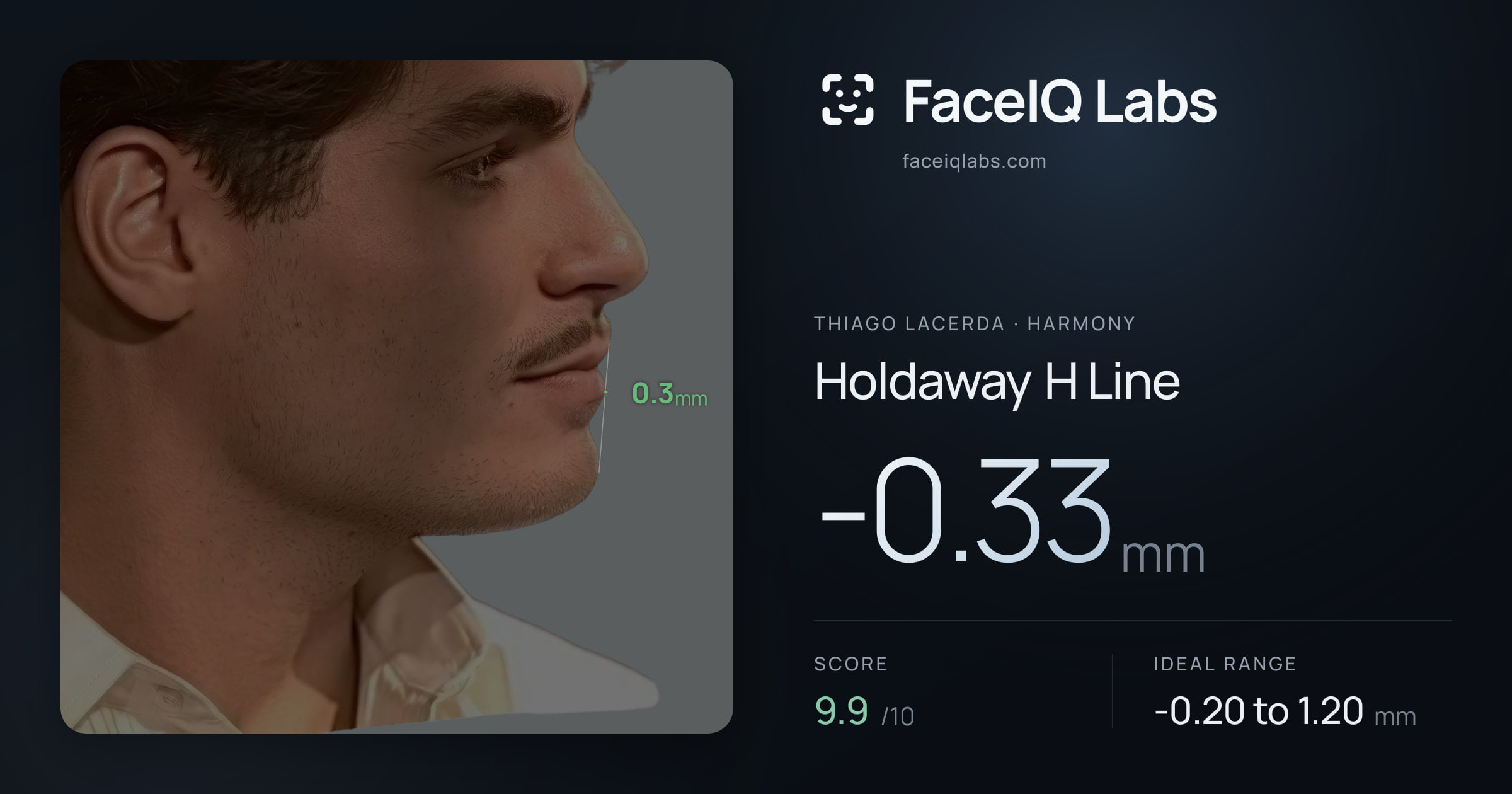 Thiago Lacerda Holdaway H Line: -0.33mm, drawn on the photo
