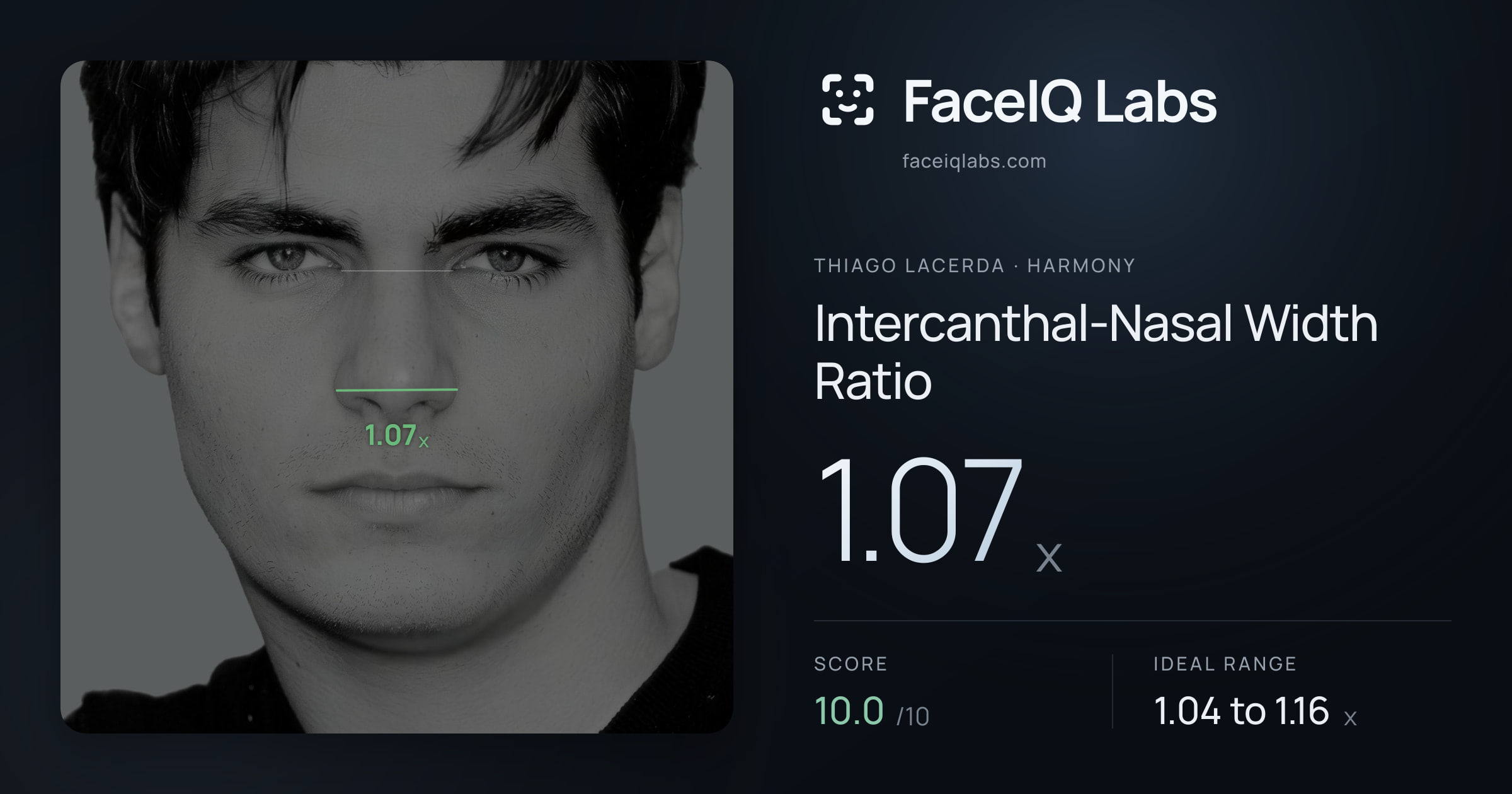 Thiago Lacerda Intercanthal-Nasal Width Ratio: 1.07x, drawn on the photo